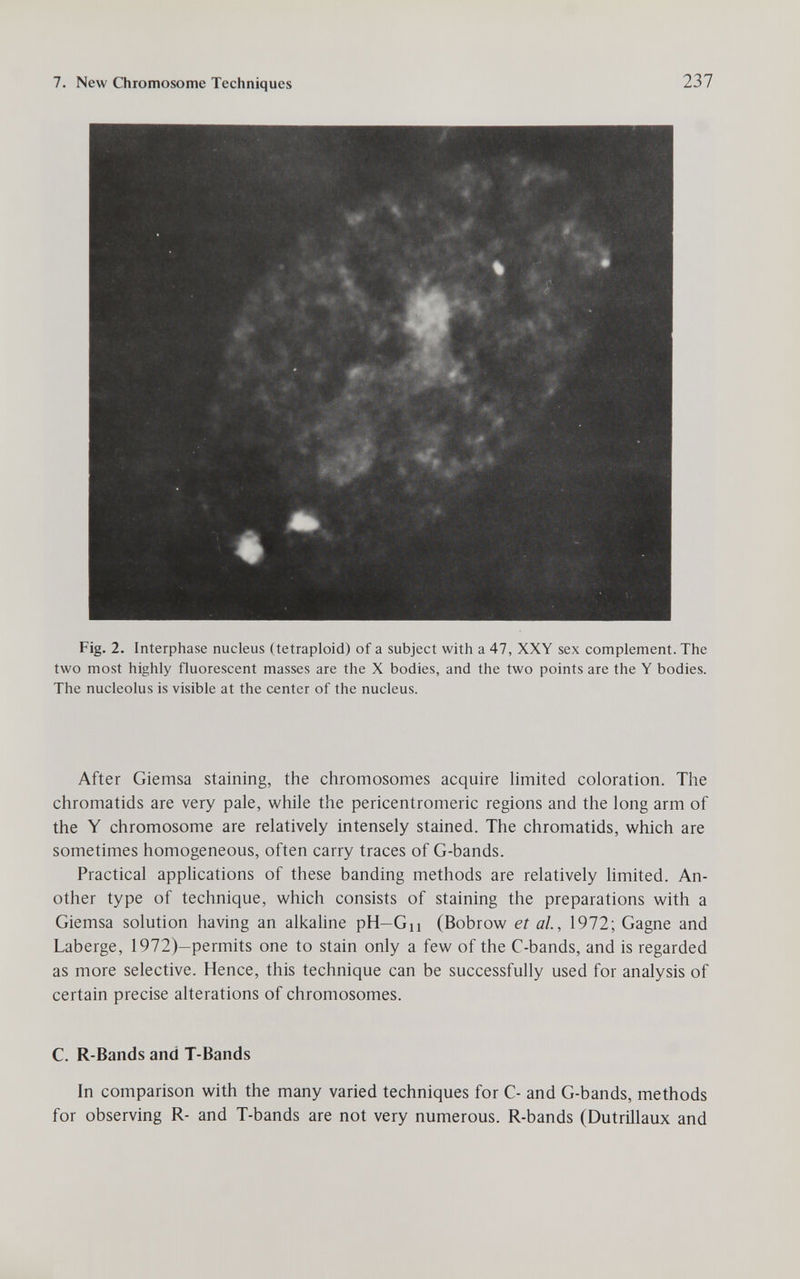 7. New Chromosome Techniques 237 Fig. 2. Interphase nucleus (tetraploid) of a subject with a 47, XXY sex complement. The two most highly fluorescent masses are the X bodies, and the two points are the Y bodies. The nucleolus is visible at the center of the nucleus. After Giemsa staining, the chromosomes acquire limited coloration. The chromatids are very pale, while the pericentromeric regions and the long arm of the Y chromosome are relatively intensely stained. The chromatids, which are sometimes homogeneous, often carry traces of G-bands. Practical applications of these banding methods are relatively hmited. An¬ other type of technique, which consists of staining the preparations with a Giemsa solution having an alkaline pH—Gn (Bobrow et al, 1972; Gagne and Laberge, 1972)—permits one to stain only a few of the C-bands, and is regarded as more selective. Hence, this technique can be successfully used for analysis of certain precise alterations of chromosomes. C. R-Bands and T-Bands In comparison with the many varied techniques for C- and G-bands, methods for observing R- and T-bands are not very numerous. R-bands (Dutrillaux and