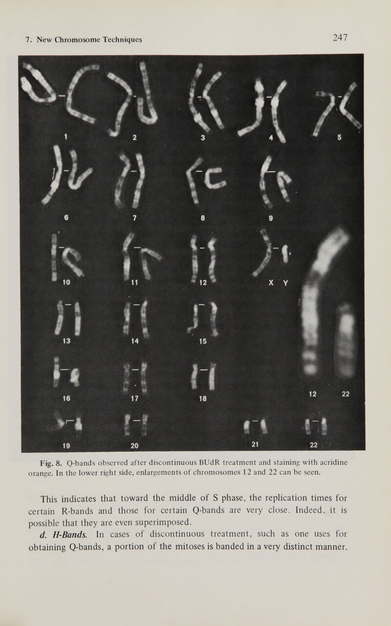 7. New Chromosome Techniques 247 6 7 8 9 Г» fi II im t Щ ■ W i® ' 5 19 20 21 22 Fig. 8. Q-bands observed after discontinuous BUdR treatment and staining with acridine orange. In the lower right side, enlargements of chromosomes 12 and 22 can be seen. This indicates that toward the middle of S phase, the replication times for certain R-bands and those for certain Q-bands are very close. Indeed, it is possible that they are even superimposed. d. H-Bands. In cases of discontinuous treatment, such as one uses for obtaining Q-bands, a portion of the mitoses is banded in a very distinct manner.