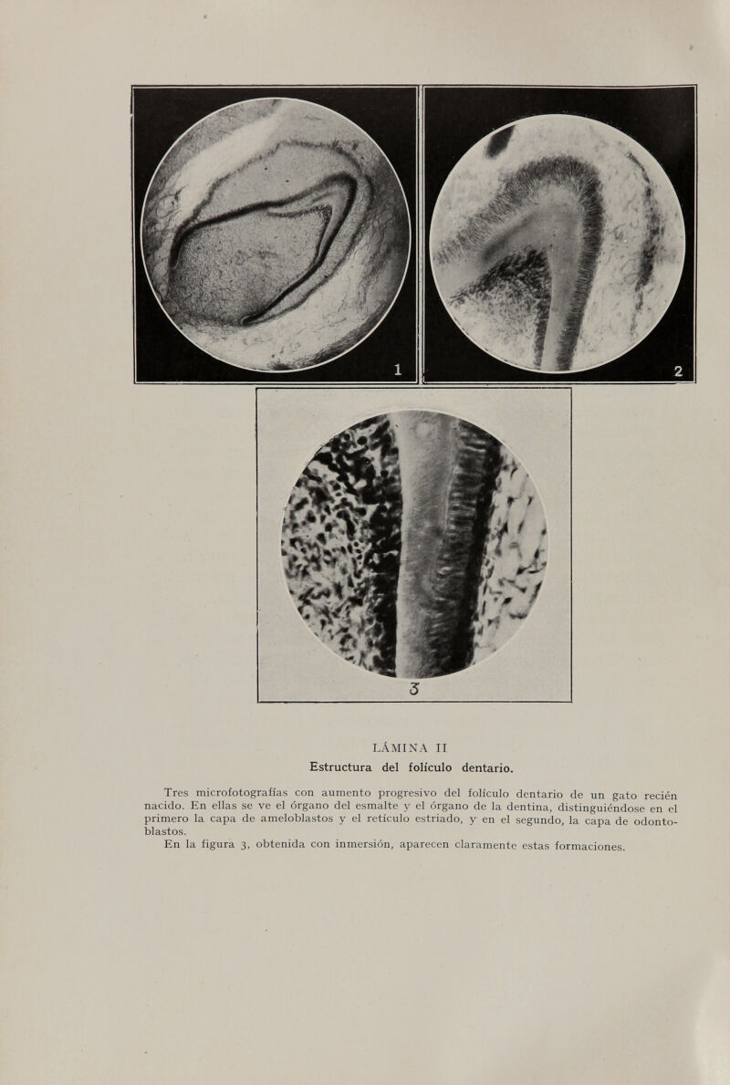 3 LÁMINA II Estructura del folículo dentario. Tres microfotografías con aumento progresivo del folículo dentario de un gato recién nacido. En ellas se ve el órgano del esmalte y el órgano de la dentina, distinguiéndose en el primero la capa de ameloblastos y el retículo estriado, y en el segundo, la capa de odonto- blastos. En la figura 3, obtenida con inmersión, aparecen claramente estas formaciones.