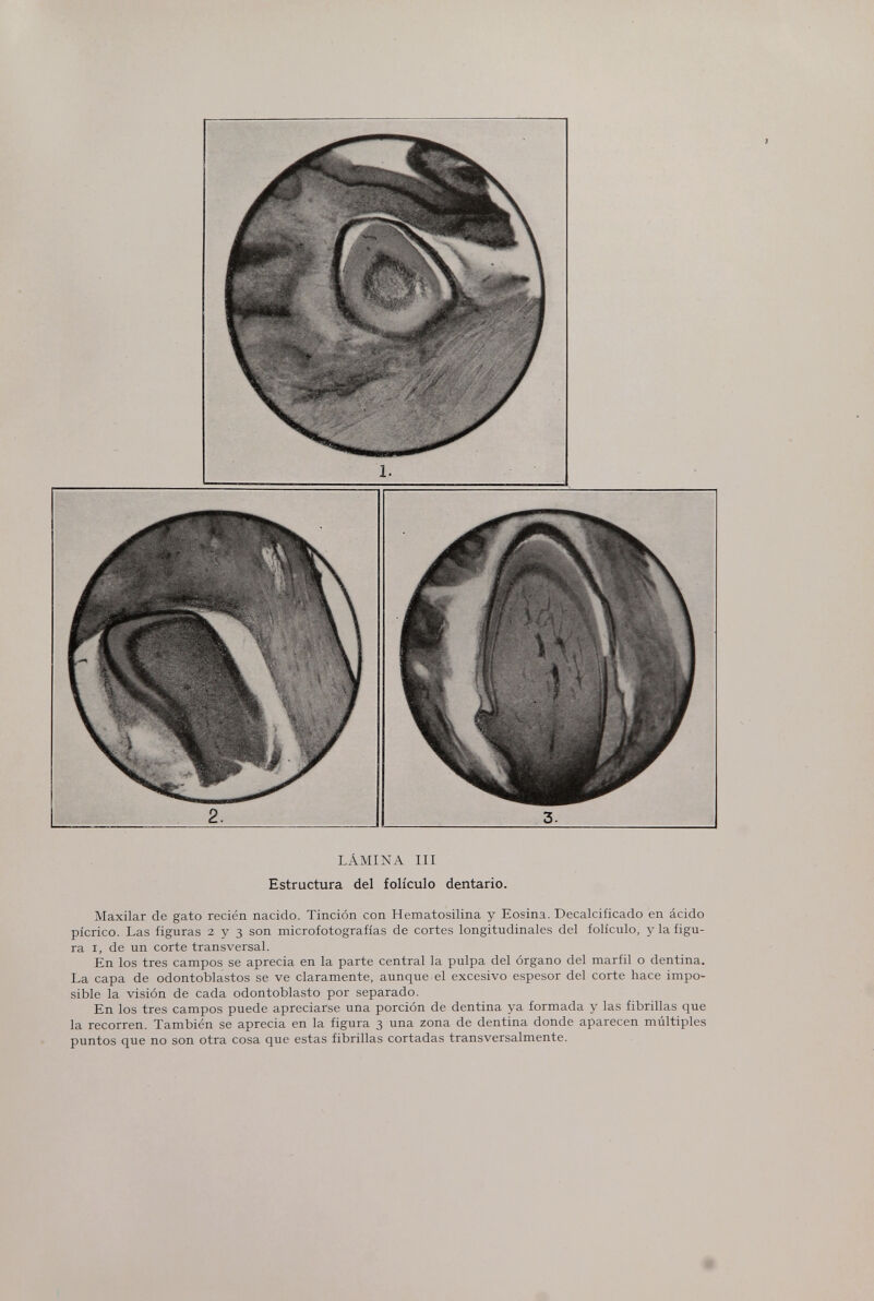 LÁMINA III Estructura del folículo dentario. Maxilar de gato recién nacido. Tinción con Hematosilina y Eosina. Decalcificado en ácido picrico. Las figuras 2 y 3 son microfotografías de cortes longitudinales del folículo, y la figu¬ ra I, de un corte transversal. En los tres campos se aprecia en la parte central la pulpa del órgano del marfil o dentina. La capa de odontoblastos se ve claramente, aunque el excesivo espesor del corte hace impo¬ sible la visión de cada odontoblasto por separado. En los tres campos puede apreciarse una porción de dentina ya formada y las fibrillas que la recorren. También se aprecia en la figura 3 una zona de dentina donde aparecen múltiples puntos que no son otra cosa que estas fibrillas cortadas transversalmente.