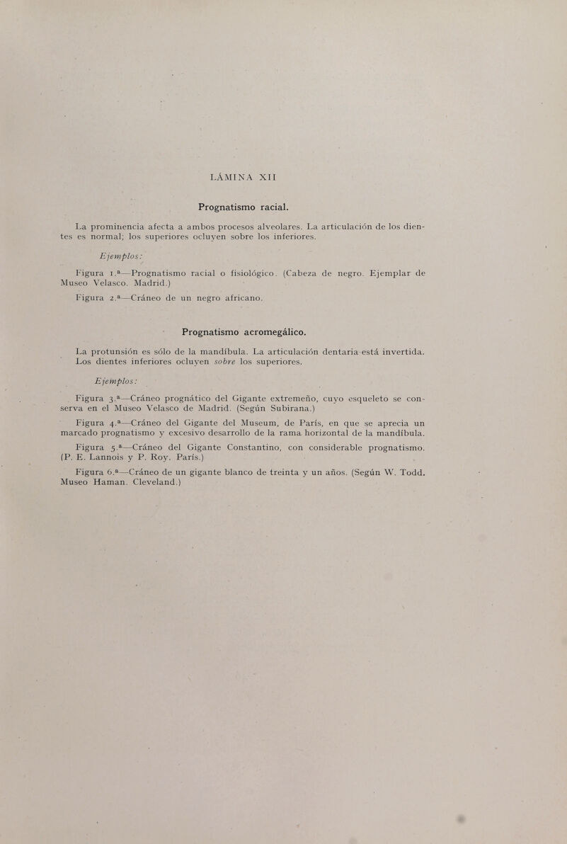 LÁMINA XII Prognatismo racial. La prominencia afecta a ambos procesos alveolares. La articulación de los dien¬ tes es normal; los superiores ocluyen sobre los inferiores. Ejemplos : / Figura i.^—Prognatismo racial o fisiológico. (Cabeza de negro. Ejemplar de Museo Velasco. Madrid.) Figura a.®'—Cráneo de un negro africano. Prognatismo acromegálico. La protunsión es sólo de la mandíbula. La articulación dentaria está invertida. Los dientes inferiores ocluyen sobre los superiores. Ejemplos: Figura 3.^—Cráneo prognàtico del Gigante extremeño, cuyo esqueleto se con¬ serva en el Museo Velasco de Madrid. (Según Subirana.) Figura 4.^—Cráneo del Gigante del Museum, de París, en que se aprecia un marcado prognatismo y excesivo desarrollo de la rama horizontal de la mandíbula. Figura —-Cráneo del Gigante Constantino, con considerable prognatismo. (P. E. Lannois y P. Roy. París.) Figura 6.a—Cráneo de un gigante blanco de treinta y un años. (Según W. Todd. Museo Haman. Cleveland.)