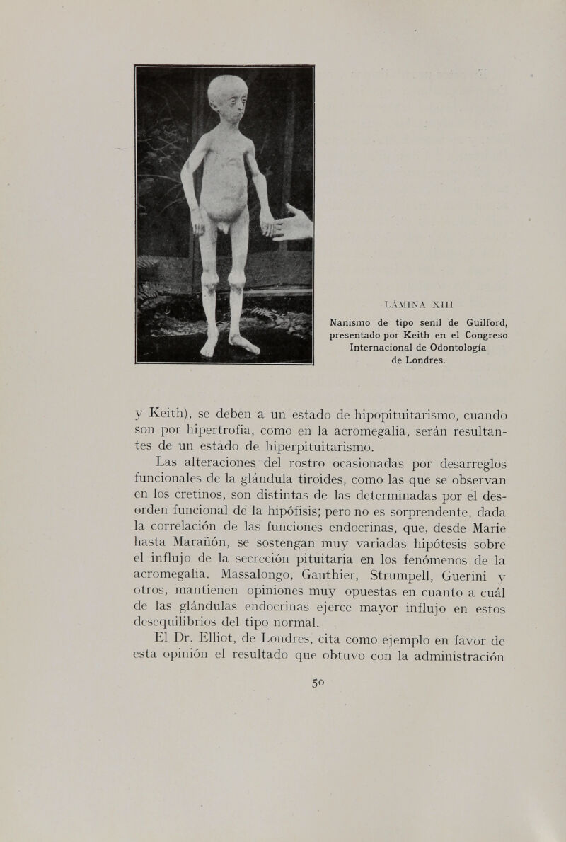 lamina хш Nanismo de tipo senil de Guilford, presentado por Keith en el Congreso Internacional de Odontología de Londres. y Keith), se deben a un estado de hipopituitarismo, cuando son por hipertrofia, como en la acromegaha, serán resultan¬ tes de un estado de hiperpituitarismo. Las alteraciones del rostro ocasionadas por desarreglos funcionales de la glándula tiroides, como las que se observan en los cretinos, son distintas de las determinadas por el des¬ orden funcional de la hipófisis; pero no es sorprendente, dada la correlación de las funciones endocrinas, que, desde Marie hasta Marañón, se sostengan muy variadas hipótesis sobre el influjo de la secreción pituitaria en los fenómenos de la acromegalia. Massalongo, Gauthier, Strümpell, Guerini y otros, mantienen opiniones muy opuestas en cuanto a cuál de las glándulas endocrinas ejerce mayor influjo en estos desequilibrios del tipo normal. El Dr. Elliot, de Londres, cita como ejemplo en favor de esta opinión el resultado que obtuvo con la administración 50