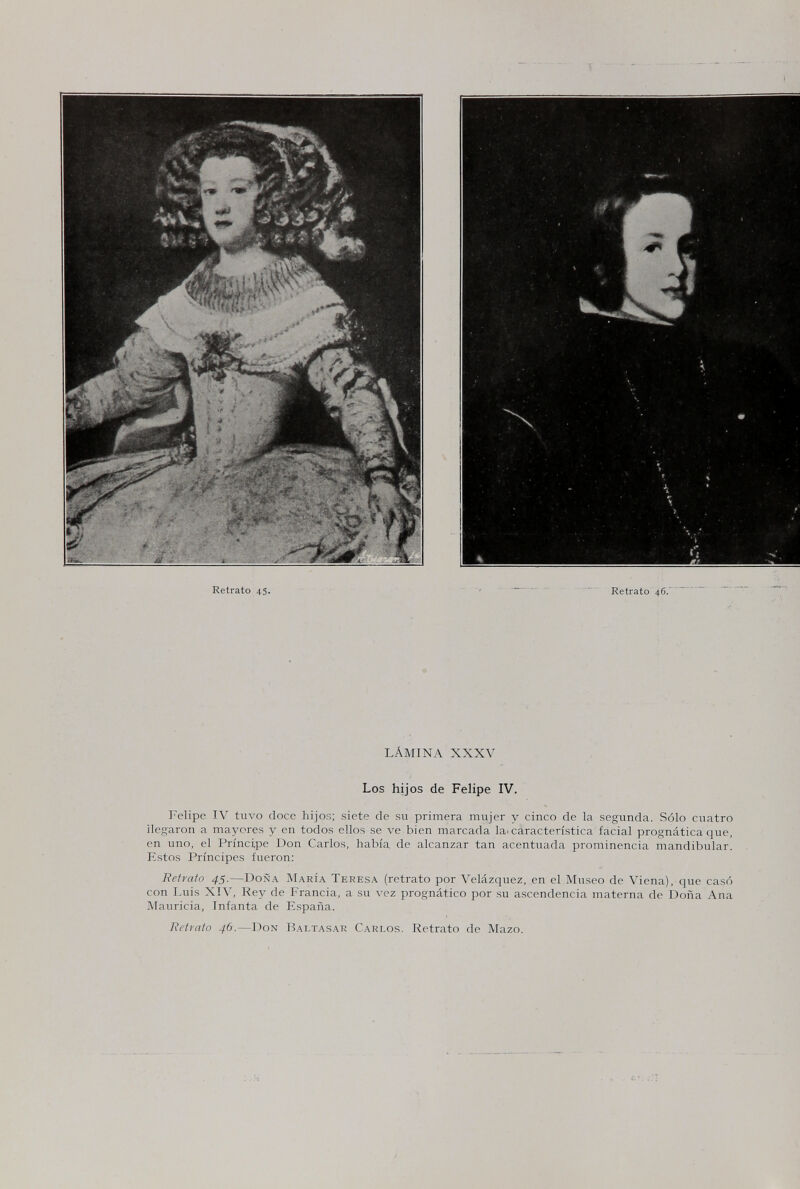 Retrato 45. Retrato 46. LÁMINA XXXV Los hijos de Felipe IV. Felipe IV tuvo doce hijos; siete de su primera mujer y cinco de la segunda. Sólo cuatro llegaron a mayores y en todos ellos se ve bien marcada la. característica facial prognàtica que, en uno, el Príncipe Don Carlos, había de alcanzar tan acentuada prominencia mandibular. Estos Príncipes fueron: Retrato 45.—Doña María Tekesa (retrato por Velázquez, en el Museo de Viena), que casó con Luis XIV, Rey de Francia, a su vez prognàtico por su ascendencia materna de Doña Ana Mauricia, Infanta de España. Retrnto 46.—Don Baltasar Carlos. Retrato de Mazo.
