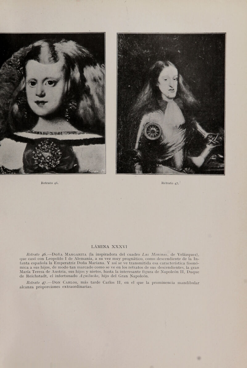Retrato 46. Retrato 47. LÁMINA XXXVI Retrato 46.—Doña Margarita (la inspiradora del cuadro Las Meninas, de Velázqucz), ((ue casó con Leopoldo I de Alemania, a su vez muy prognàtico, como descendiente de la In¬ fanta española la Emperatriz Doña Mariana. Y así se ve transmitida esa característica íisonó- niica a sus hijos, de modo tan marcado como se ve en los retratos de sus descendientes, la gran María Teresa de Austria, sus hijos y nietos, hasta la interesante figura de Napoleón II, Duque de Reichstadt, el infortunado A f^uilucko, hijo del Gran Napoleón. Retrato 47.—Don Carlos, más tarde Carlos II, en el que la prominencia mandibular alcanza proporciones extraordinarias.