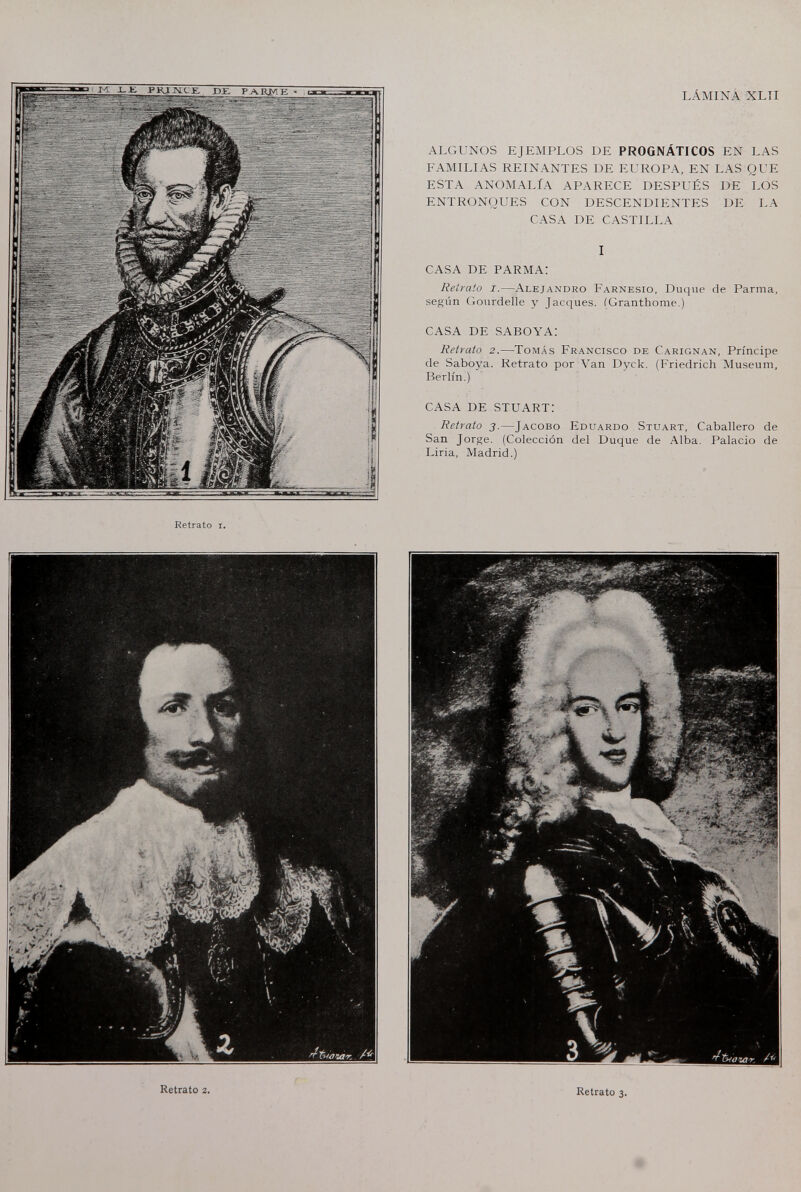 LÁMINA XLTI ALGUNOS EJEMPLOS DE PROGNÁTICOS EN LAS FAMILIAS REINANTES DE EUROPA, EN LAS QUE ESTA ANOMALÍA APARECE DESPUÉS DE LOS ENTRONQUES CON DESCENDIENTES DE LA CASA DE CASTILLA I CASA DE PARMA: Retrato i.—Alejandro Farnesio, Duque de Parma, según (iourdelle y Jacques. (Granthome.) CASA DE SABOYA: Retrato 2.—Tomás Francisco de Carignan, Príncipe de Saboya. Retrato por Van Dyck. (Friedrich Museum, Berlín.) CASA DE STUART: Retrato 3.—Jacobo Eduardo Stuart, Caballero de San Jorge. (Colección del Duque de Alba. Palacio de Liria, Madrid.) Retrato 2. Retrato 3.
