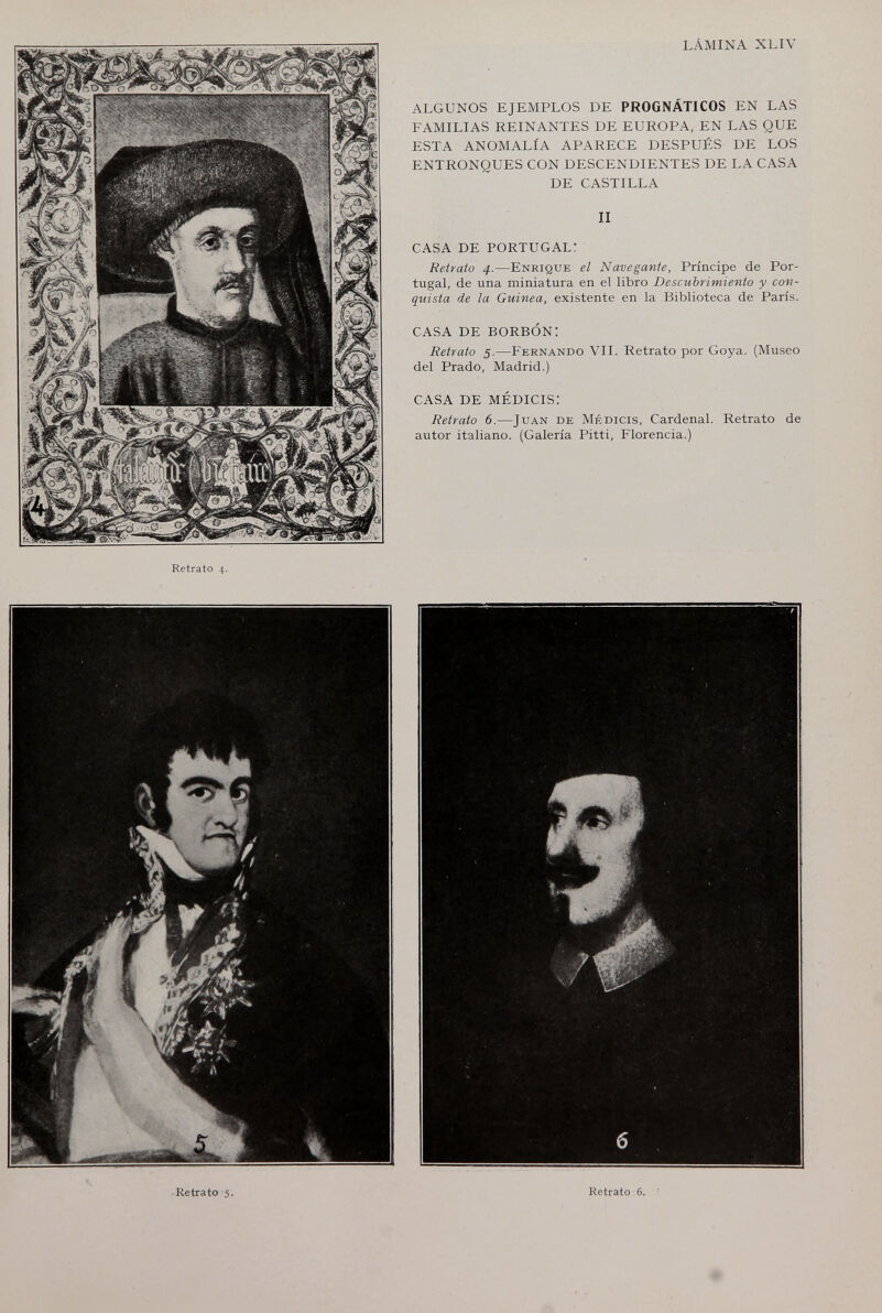 Retrato 4. LÁMINA XLIV ALGUNOS EJEMPLOS DE PROGNÁTICOS EN LAS FAMILIAS REINANTES DE EUROPA, EN LAS QUE ESTA ANOMALÍA APARECE DESPUÉS DE LOS ENTRONQUES CON DESCENDIENTES DE LA CASA DE CASTILLA II CASA DE PORTUGAL: Retrato 4.—Enrique el Navegante, Príncipe de Por¬ tugal, de una miniatura en el libro Descubrimiento y con¬ quista de la Guinea, existente en la Biblioteca de París. CASA DE BORBÓN: Retrato 5.—Fernando VII. Retrato por Goya. (Museo del Prado, Madrid.) CASA DE MÉDICIS: Retrato 6.—Juan de Médicis, Cardenal. Retrato de autor italiano. (Galería Pitti, Florencia.)