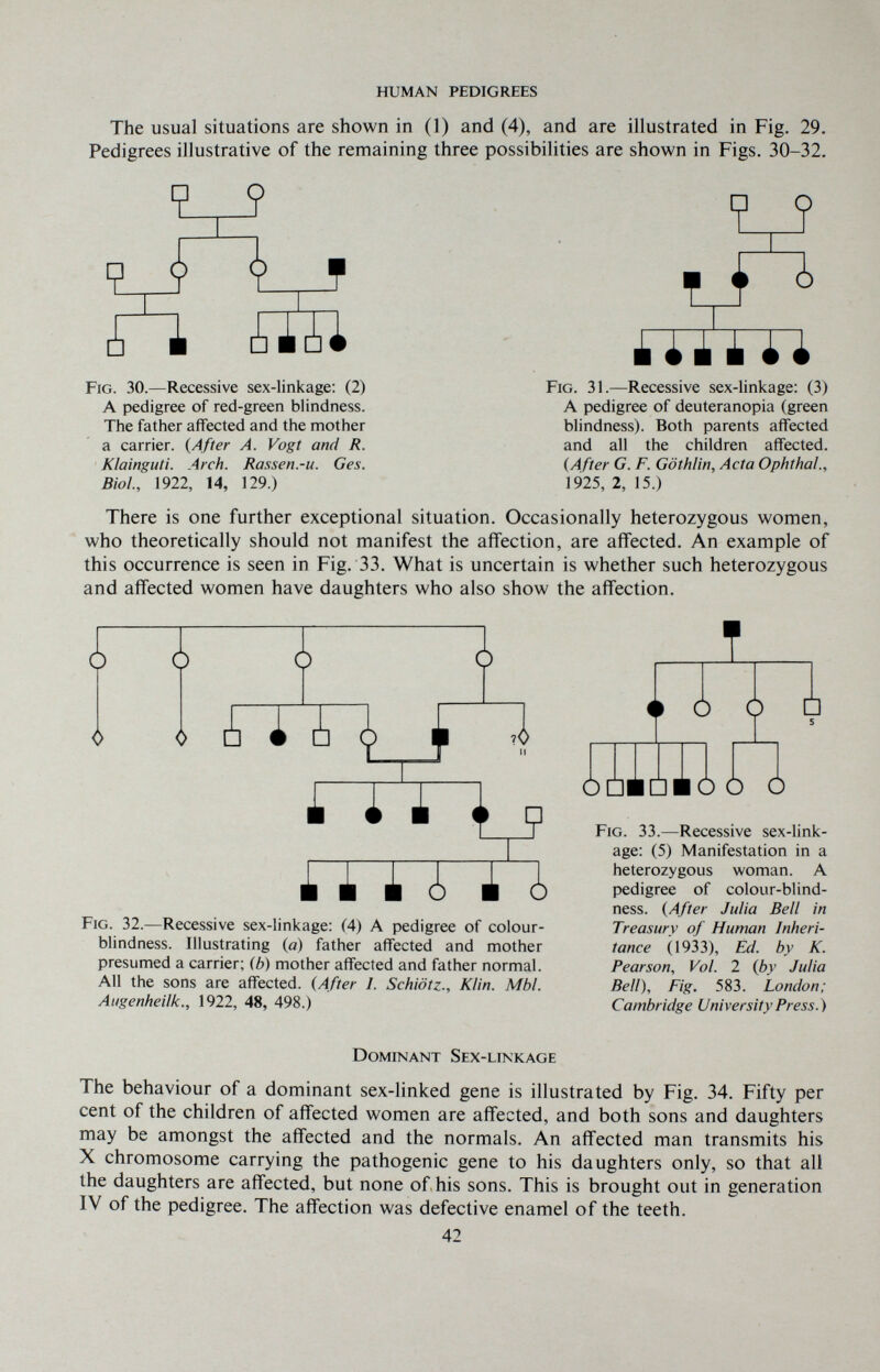 HUMAN PEDIGREES The usual situations are shown in (1) and (4), and are illustrated in Fig, 29. Pedigrees illustrative of the remaining three possibilities are shown in Figs. 30-32. i 4 ¿bÍÍ Fig. 30.—Recessive sex-linkage: (2) A pedigree of red-green blindness. The father affected and the mother a carrier. {After A. Vogt and R. Klainguti. Arch. Rassen.-u. Ges. Biol., 1922, 14, 129.) M Fig. 31.—Recessive sex-linkage: (3) A pedigree of deuteranopia (green blindness). Both parents affected and all the children affected. (After G. F. Göthlin, Acta Ophthal., 1925, 2, 15.) There is one further exceptional situation. Occasionally heterozygous women, who theoretically should not manifest the affection, are affected. An example of this occurrence is seen in Fig. 33. What is uncertain is whether such heterozygous and affected women have daughters who also show the aff'ection. i ¿¡ i ¿ (|) ^ 4 1 tii □ ii i ¿ 1 ¿ Fig. 32.—Recessive sex-linkage: (4) A pedigree of colour¬ blindness. Illustrating (a) father affected and mother presumed a carrier; (b) mother affected and father normal. All the sons are affected. (After I. Schiötz., Klin. МЫ. Augenheilk., 1922, 48, 498.) ÒÙÉÙÉÒÒ Ó Fig. 33.—Recessive sex-link¬ age: (5) Manifestation in a heterozygous woman. A pedigree of colour-blind¬ ness. (After Julia Bell in Treasury of Human Inheri¬ tance Ó 933), Ed. by K. Pearson, Vol. 1 (by Julia Bell), Fig. 583. London; Cambridge UniversityPress.^ Dominant Sex-linkage The behaviour of a dominant sex-linked gene is illustrated by Fig. 34. Fifty per cent of the children of aff'ected women are affected, and both sons and daughters may be amongst the aff'ected and the normals. An aff'ected man transmits his X chromosome carrying the pathogenic gene to his daughters only, so that all the daughters are aff'ected, but none of his sons. This is brought out in generation IV of the pedigree. The affection was defective enamel of the teeth. 42