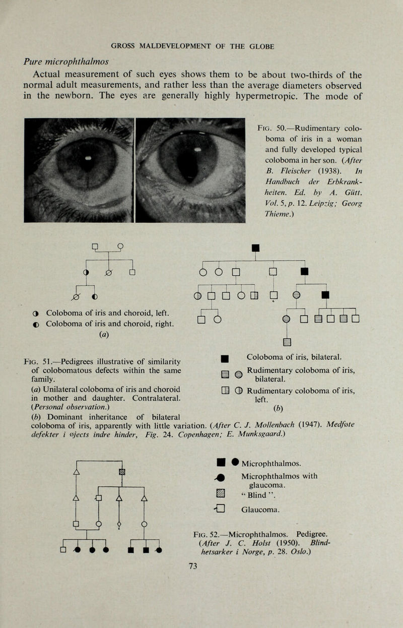 GROSS MALDEVELOPMENT OF THE GLOBE Pure microphthalmos Actual measurement of such eyes shows them to be about two-thirds of the normal adult measurements, and rather less than the average diameters observed in the newborn. The eyes are generally highly hypermetropic. The mode of Fig. 50.—Rudimentary colo¬ boma of iris in a woman and fully developed typical coloboma in her son. {After B. Fleischer (1938). In Handbuch der Erbkrank¬ heiten. Ed. by A. Gütt. Vol. 5, p. 12. Leipzig; Georg Thieme.) 0 л Э Coloboma of iris and choroid, left. С Coloboma of iris and choroid, right, (a) ¿ ¿ [^ Û i à à ¿ tì ф fió Coloboma of iris, bilateral. Fig. 51.—Pedigrees illustrative of similarity ' of colobomatous defects within the same family. (а) Unilateral coloboma of iris and choroid in mother and daughter. Contralateral. {Personal observation?} (б) Dominant inheritance of bilateral coloboma of iris, apparently with little variation. {After C. J. MoUenbach (1947). Medfete defekter i ejects indre hinder. Fig. 24. Copenhagen; E. Munksgaard.) Ä Rudimentary coloboma of iris, bilateral. 0 Rudimentary coloboma of iris, left. Ф) I A Ч Í ¿ I i 0 m -□ Microphthalmos. Microphthalmos with glaucoma. Blind. Glaucoma. Fig. 52.—Microphthalmos. Pedigree. {After J. C. Hoist (1950). Blind- hetsarker i Norge, p. 28. Oslo.) 73