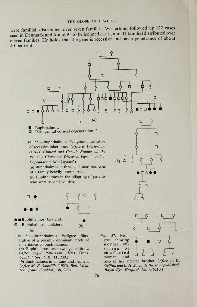 \ THE GLOBE AS A WHOLE were familial, distributed over seven families. Westerland followed up 122 cases seen in Denmark and found 91 to be isolated cases, and 31 familial distributed over eleven families. He holds that the gene is recessive and has a penetrance of about 40 per cent. i { \ 'LJ AilUUin 0 0 0 0 7 s 5 20 U (a) ■ Buphthalmos. Ш Congenital corneal degeneration.' Fig. 55.—Buphthalmos. Pedigrees illustrative of recessive inheritance. {After E. Westerland (1947). Clinical and Genetic Studies on the Primary Glaucoma Diseases, Figs. 4 and 5. Copenhagen: Munksgaard.) (а) Buphthalmos in three collateral branches of a family heavily intermarried. (б) Buphthalmos in the offspring of parents who were second cousins. шт I 7: Ф) i dbé 4 íó m i ¿ • ■Buphthalmos, bilateral. Ö Buphthalmos, unilateral. (a) u Ф9 Ч__9 (6) Fig. 56.—Buphthalmos. Pedigrees illus¬ trative of a possibly dominant mode of inheritance of buphthalmos. (а) Buphthalmos over two generations. (After Argyll Robertson (1891). Trans. Ophthal. Soc. U.K., II, 239.) (б) Buphthalmos in an aunt and nephew. {After M. E. Sourdille (1925). Bull. Mém. Soc. franc, d'ophtal., 38, 229). Fig. 57.—Pedi¬ gree showing normal ofî- spring of an affected woman and □ Л л о also of her affected brother. {After A. D. Griffith andL. H. Savin. Hitherto unpublished. Royal Eye Hospital No. 0/6210.) 76
