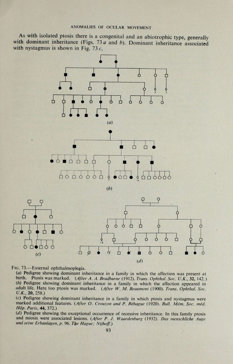 ANOMALIES OF OCULAR MOVEMENT As with isolated ptosis there is a congenital and an abiotrophic type, generally with dominant inheritance (Figs. 73 û and b). Dominant inheritance associated with nystagmus is shown in Fig. 73 c. Í I a n f r~n 0 0 3 3 i i 1 i ¿ i i A rm im п. (а) t I T f t Ф) firn { V Ь£ (с) i M ¿ i i A m (Л Fig. 73.—External ophthalmoplegia. (a) Pedigree showing dominant inheritance in a family in which the affection was present at birth. Ptosis was marked. (After A. A. Bradburne (1912). Trans. Ophthal. Soc. U.K., 32, 142.) (Jb) Pedigree showing dominant inheritance in a family in which the affection appeared in adult life. Here too ptosis was marked. {After W. M. Beaumont (1900). Trans. Ophthal. Soc. U.K., 20, 258.) (c) Pedigree showing dominant inheritance in a family in which ptosis and nystagmus were marked additional features. {After O. Crouzon and P. Béhague (1920). Bull. Mém. Soc. méd. Hop, Paris, 44, 372.) (d) Pedigree showing the exceptional occurrence of recessive inheritance. In this family ptosis and miosis were associated lesions. (After P. J. Waardenburg (1932). Das menschliche Auge und seine Erbanlagen, p. 96. Tbe Hague; Nijhoff.) 93