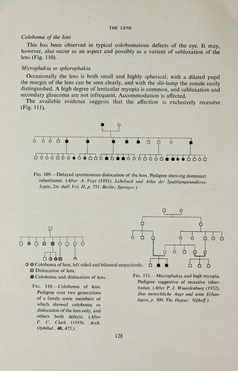 THE LENS Coloboma of the lens This has been observed in typical colobomatous defects of the eye. It may, however, also occur as an aspect and possibly as a variant of subluxation of the lens (Fig. 110). Microphakia or spherophakia Occasionally the lens is both small and highly spherical; with a dilated pupil the margin of the lens can be seen clearly, and with the slit-lamp the zonule easily distinguished. A high degree of lenticular myopia is common, and subluxation and secondary glaucoma are not infrequent. Accommodation is affected. The available evidence suggests that the affection is exclusively recessive (Fig. ill). T? à ¿¿¿¿¿¿4 ¿ ¿ Ò ¿I ¿ ib [b ¿ ¿ ¿ ¿ ¿ ¿) ¿ ¿ ¿ Fig. 109.—Delayed spontaneous dislocation of the lens. Pedigree showing dominant inheritance. {After A. Vogt (1931). Lehrbuch und Atlas der Spaltlampenmikros¬ kopie, Ite Aufl. Vol. II, /7. 751. Berlin; Springer.) i Hi ¿i I Coloboma of lens, left sided and bilateral respectively. I Dislocation of lens. I Coloboma and dislocation of lens. Fig. 110.—Coloboma of lens. Pedigree over two generations of a family some members of which showed coloboma oi dislocation of the lens only, and others both defects. {After F. C. Clark (1919). Arch. Ophthal., 48, 475.) Fig. 111.—Microphakia and high myopia. Pedigree suggestive of recessive inher¬ itance. {After P. J. Waardenburg (1932). Das menschliche Auge und seine Erban¬ lagen, p. 309. The Hague; Nijhoff.) 128