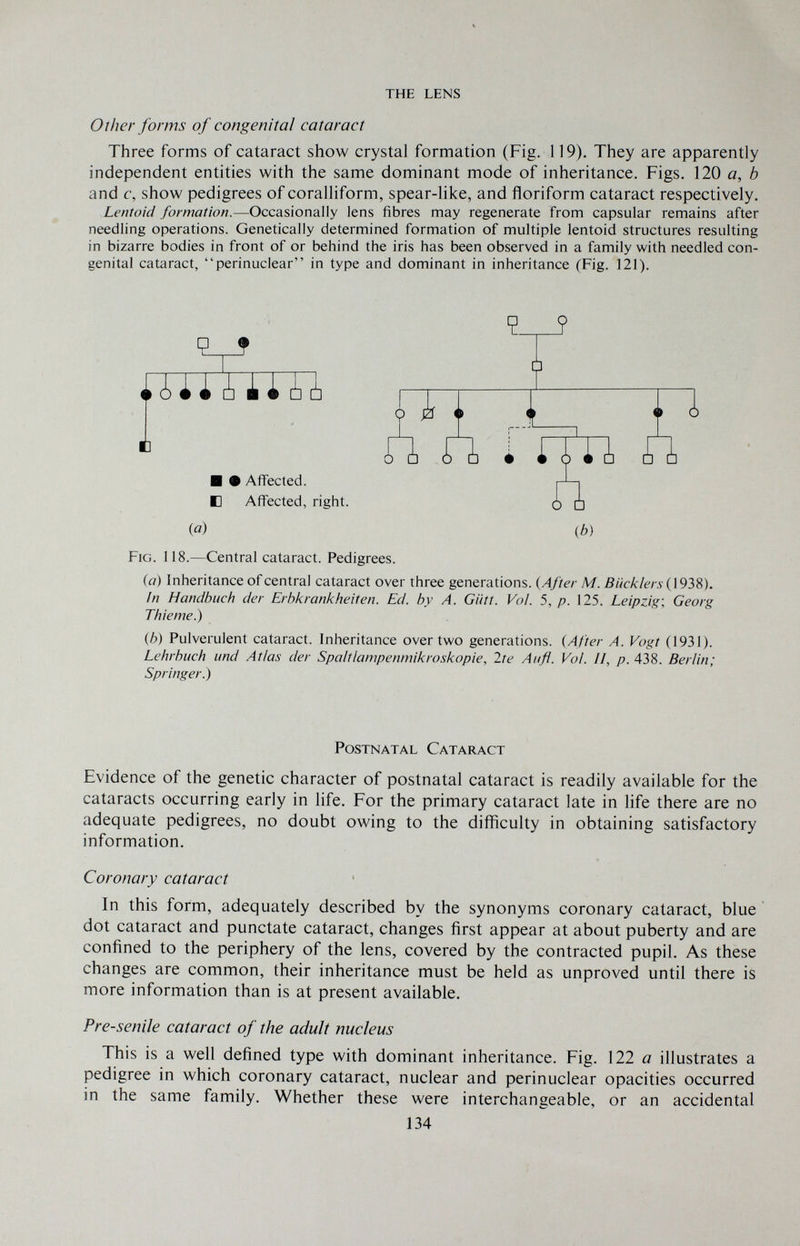 the lens Other forms of congenital cataract Three forms of cataract show crystal formation (Fig. 119). They are apparently independent entities with the same dominant mode of inheritance. Figs. 120 a, b and c, show pedigrees of coralliform, spear-like, and floriform cataract respectively. Lentoid formation.—Occasionally lens fibres may regenerate from capsular remains after needling operations. Genetically determined formation of multiple lentoid structures resulting in bizarre bodies in front of or behind the iris has been observed in a family with needled con¬ genital cataract, perinuclear in type and dominant in inheritance (Fig. 121). Fig. 118.—Central cataract. Pedigrees. (a) Inheritance of central cataract over three generations. {After M. ßмc^/m■( 1938). In Handbuch der Erhl<rankheiten. Ed. by A. Giitt. Vol. 5, p. 125. Leipzig', Georg Thieme.) {h) Pulverulent cataract. Inheritance over two generations. (After A. Vogt (1931). Lehrbuch und Atias der Spaltlampenmikroskopie, Ire Aufl. VoL //, p. 438. Berlin; Springer.) Evidence of the genetic character of postnatal cataract is readily available for the cataracts occurring early in life. For the primary cataract late in life there are no adequate pedigrees, no doubt owing to the difficulty in obtaining satisfactory information. Coronary cataract In this form, adequately described by the synonyms coronary cataract, blue dot cataract and punctate cataract, changes first appear at about puberty and are confined to the periphery of the lens, covered by the contracted pupil. As these changes are common, their inheritance must be held as unproved until there is more information than is at present available. Presenile cataract of the adult nucleus This is a well defined type with dominant inheritance. Fig. 122 a illustrates a pedigree in which coronary cataract, nuclear and perinuclear opacities occurred in the same family. Whether these were interchangeable, or an accidental Ф) Postnatal Cataract 134