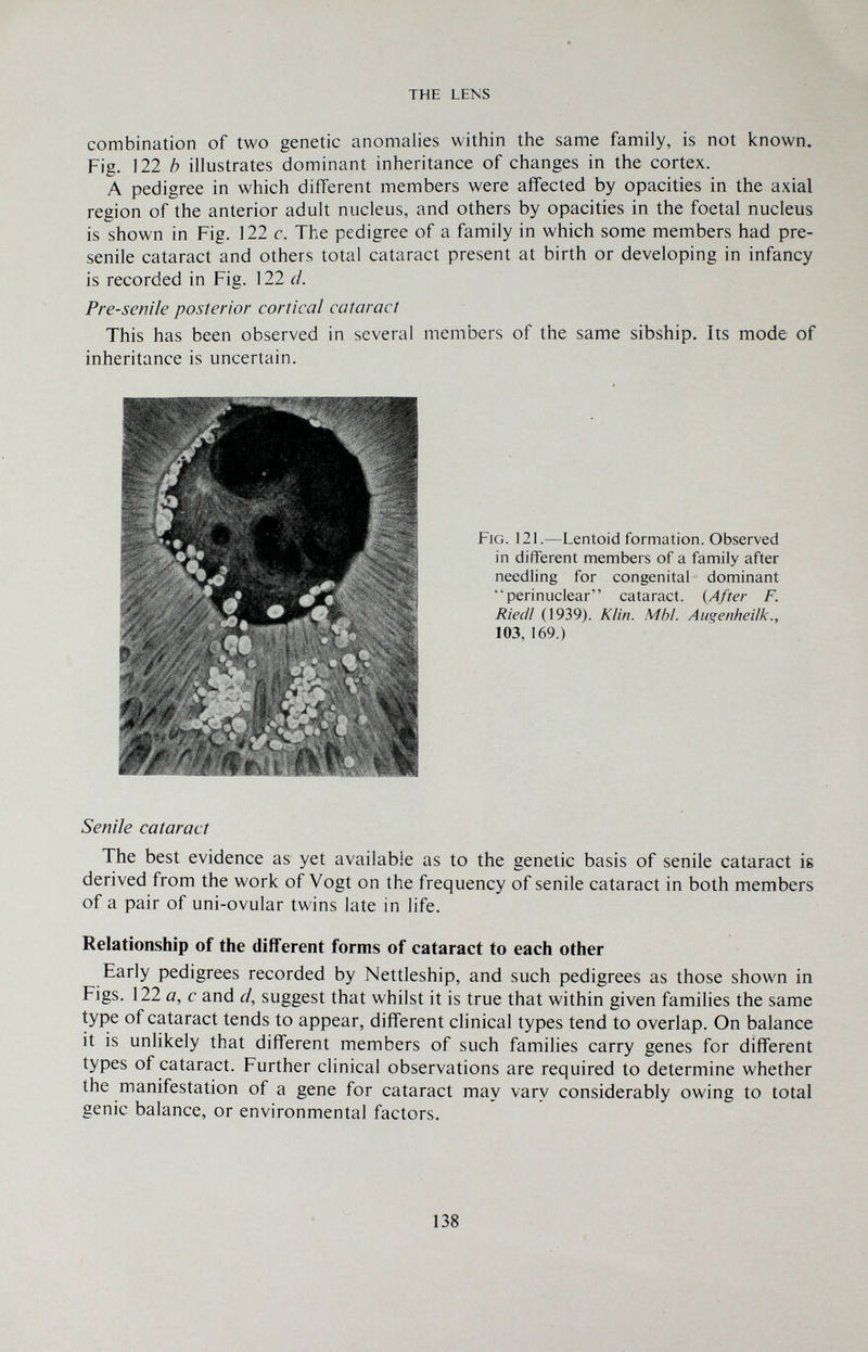 THE LENS combination of two genetic anomalies within the same family, is not known. Fig. 122 b illustrates dominant inheritance of changes in the cortex. A pedigree in which different members were affected by opacities in the axial region of the anterior adult nucleus, and others by opacities in the foetal nucleus is shown in Fig. 122 c. The pedigree of a family in which some members had pre¬ senile cataract and others total cataract present at birth or developing in infancy is recorded in Fig. 122 d. Presenile posterior cortical cataract This has been observed in several members of the same sibship. Its mode of inheritance is uncertain. Fig. 121.—Lentoid formation. Observed in different members of a family after needling for congenital dominant perinuclear cataract. {After F. Riedl (1939). Klin. M hi. Augenheiìì<., 103, 169.) Senile cataract The best evidence as yet available as to the genetic basis of senile cataract is derived from the work of Vogt on the frequency of senile cataract in both members of a pair of uni-ovular twins late in life. Relationship of the different forms of cataract to each other Early pedigrees recorded by Nettleship, and such pedigrees as those shown in Figs. 122 a, с and cl, suggest that whilst it is true that within given families the same type of cataract tends to appear, different clinical types tend to overlap. On balance it is unlikely that different members of such families carry genes for different types of cataract. Further clinical observations are required to determine whether the manifestation of a gene for cataract may vary considerably owing to total genie balance, or environmental factors. 138