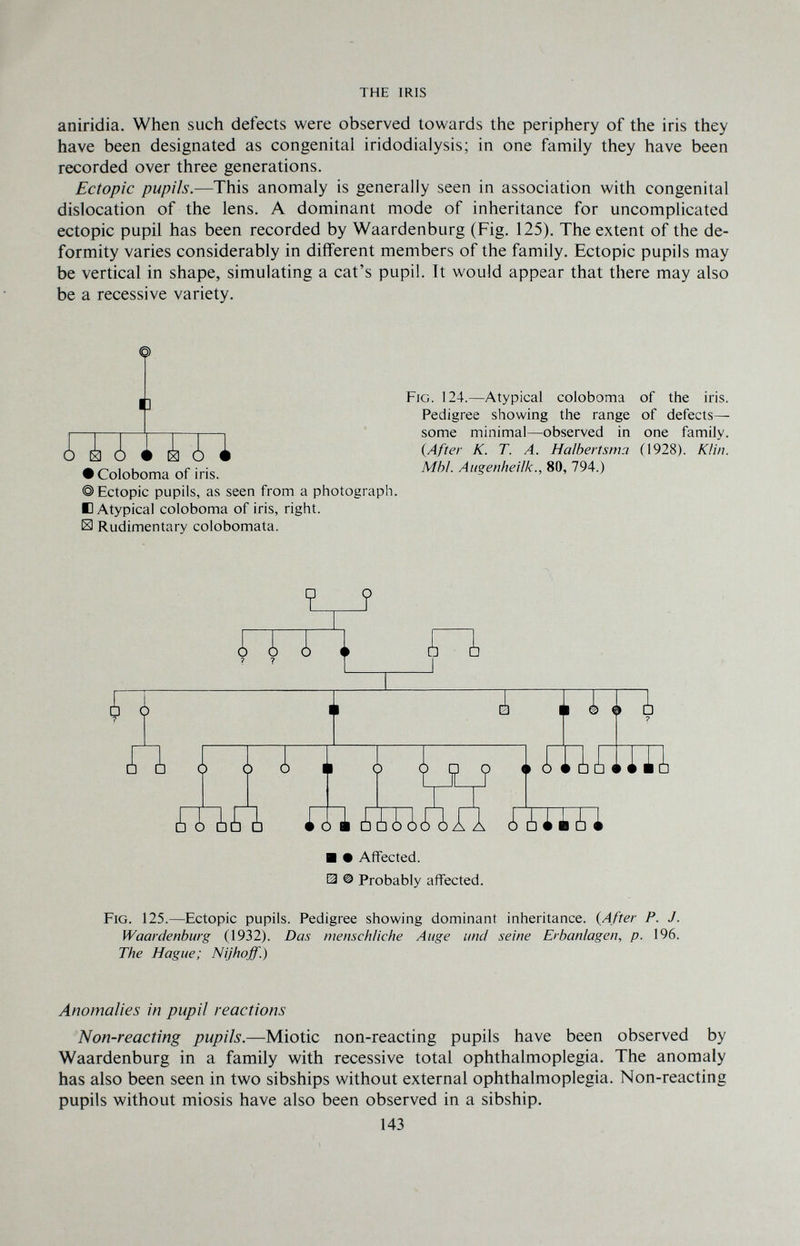 THE IRIS aniridia. When such defects were observed towards the periphery of the iris they have been designated as congenital iridodialysis; in one family they have been recorded over three generations. Ectopic pupils.—This anomaly is generally seen in association with congenital dislocation of the lens. A dominant mode of inheritance for uncomplicated ectopic pupil has been recorded by Waardenburg (Fig. 125). The extent of the de¬ formity varies considerably in different members of the family. Ectopic pupils may be vertical in shape, simulating a cat's pupil. It would appear that there may also be a recessive variety. mtm • Coloboma of iris. ©Ectopic pupils, as seen from a photograph. В Atypical coloboma of iris, right. S Rudimentary colobomata. Fig. 124.—Atypical coloboma of the iris. Pedigree showing the range of defects— some minimal—observed in one family. (After K. T. A. Halbertsma (1928). KUn. Mhl. Aiigenheilk., 80, 794.) ши ш тип шт ■ • Affected. Э © Probably affected. Fig. 125.—Ectopic pupils. Pedigree showing dominant inheritance. {After P. J. Waardenburg (1932). Das menschliche Auge und seine Erbanlagen, p. 196. The Hague; Nijhoff.) Anomalies in pupil reactions Non-reacting pupils.—Miotic non-reacting pupils have been observed by Waardenburg in a family with recessive total ophthalmoplegia. The anomaly has also been seen in two sibships without external ophthalmoplegia. Non-reacting pupils without miosis have also been observed in a sibship. 143