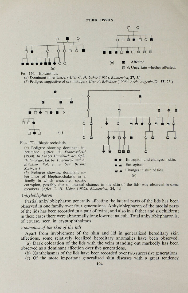 OTHER TISSUES 9 f ? am Ò о ¿ i i □ ¿ и (b) ■ Affected. В Ш Uncertain whether affected. («) Fig. 176.—Epicanthus. (a) Dominant inheritance. {After C. H. Usher (1935). Biometrica, 27, 5.) (¿) Pedigree suggestive of sex-linkage. {After A. Brückner (1906). Arch. Augenheilk., 55, 23.) Í I t Ä □ 1 ¿là A (û) í i п I 4 1 û Ti U Ш 1 mail a г ■ • H e в e Entropion and changes in skin. Entropion. Changes in skin of lids. (b) Fig. 177.—Blepharochalasis. (a) Pedigree showing dominant in¬ heritance. {After A. Franceschetti (1930). In Kurzes Handbuch der Oph¬ thalmologie, Ed. by F. Schieck and A. Brückner. Vol. 1., p. 679. Berlin; Springer.) (b) Pedigree showing dominant in¬ heritance of blepharochalasis in a family in which associated spastic entropion, possibly due to unusual changes in the skin of the lids, was observed in some members. {After C. H. Usher (1932). Biometrica, 24, 1.) Ankyloblepharon Partial ankyloblepharon generally affecting the lateral parts of the lids has been observed in one family over four generations. Ankyloblepharon of the medial parts of the lids has been recorded in a pair of twins, and also in a father and six children; in these cases there were abnormally long lower canalculi. Total ankyloblepharon is, of course, seen in cryptophthalmos. Anomalies of the skin of the lids Apart from involvement of the skin and lid in generalized hereditary skin affections, some relatively localized hereditary anomalies have been observed. (a) Dark coloration of the lids with the veins standing out markedly has been observed as a dominant affection over five generations. (b) Xanthelasmas of the lids have been recorded over two successive generations. (c) Of the more important generalized skin diseases with a great tendency 194