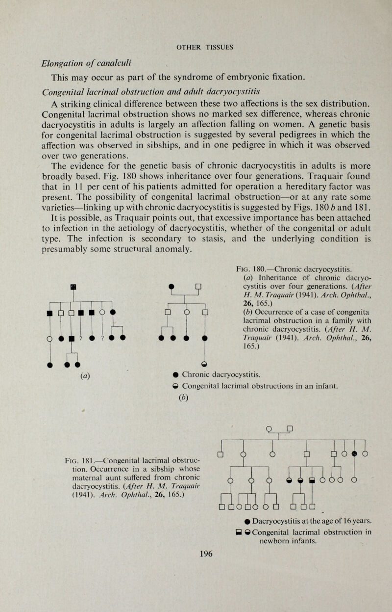 OTHER TISSUES Elongation of canalculi This may occur as part of the syndrome of embryonic fixation. Congenital lacrimal obstruction and adult dacryocystitis A striking clinical difference between these two affections is the sex distribution. Congenital lacrimal obstruction shows no marked sex difference, whereas chronic dacryocystitis in adults is largely an affection falling on women. A genetic basis for congenital lacrimal obstruction is suggested by several pedigrees in which the affection was observed in sibships, and in one pedigree in which it was observed over two generations. The evidence for the genetic basis of chronic dacryocystitis in adults is more broadly based. Fig. 180 shows inheritance over four generations. Traquair found that in 11 per cent of his patients admitted for operation a hereditary factor was present. The possibility of congenital lacrimal obstruction^—or at any rate some varieties—Unking up with chronic dacryocystitis is suggested by Figs. 180 è and 181. It is possible, as Traquair points out, that excessive importance has been attached to infection in the aetiology of dacryocystitis, whether of the congenital or adult type. The infection is secondary to stasis, and the underlying condition is presumably some structural anomaly. Fig. 180.—Chronic dacryocystitis. I 6 5 Ò (a) Inheritance of chronic dacryo¬ cystitis over four generations. (After H. M. Traquair (1941). Arch. Ophthal., 26, 165.) (6) Occurrence of a case of congenita lacrimal obstruction in a family with chronic dacryocystitis. {After H. M. Traquair (1941). Arch. Ophthal., 26, 165.) (й) Q • Chronic dacryocystitis. О Congenital lacrimal obstructions in an infant. iP) OP Fig. 181.—Congenital lacrimal obstruc¬ tion. Occurrence in a sibship whose maternal aunt suffered from chronic dacryocystitis. {After H. M. Traquair (1941). .Arch. Ophthal., 26, 165.) • Dacryocystitis at the age of 16 years. У e Congenital lacrimal obstruction in newborn infants. 196
