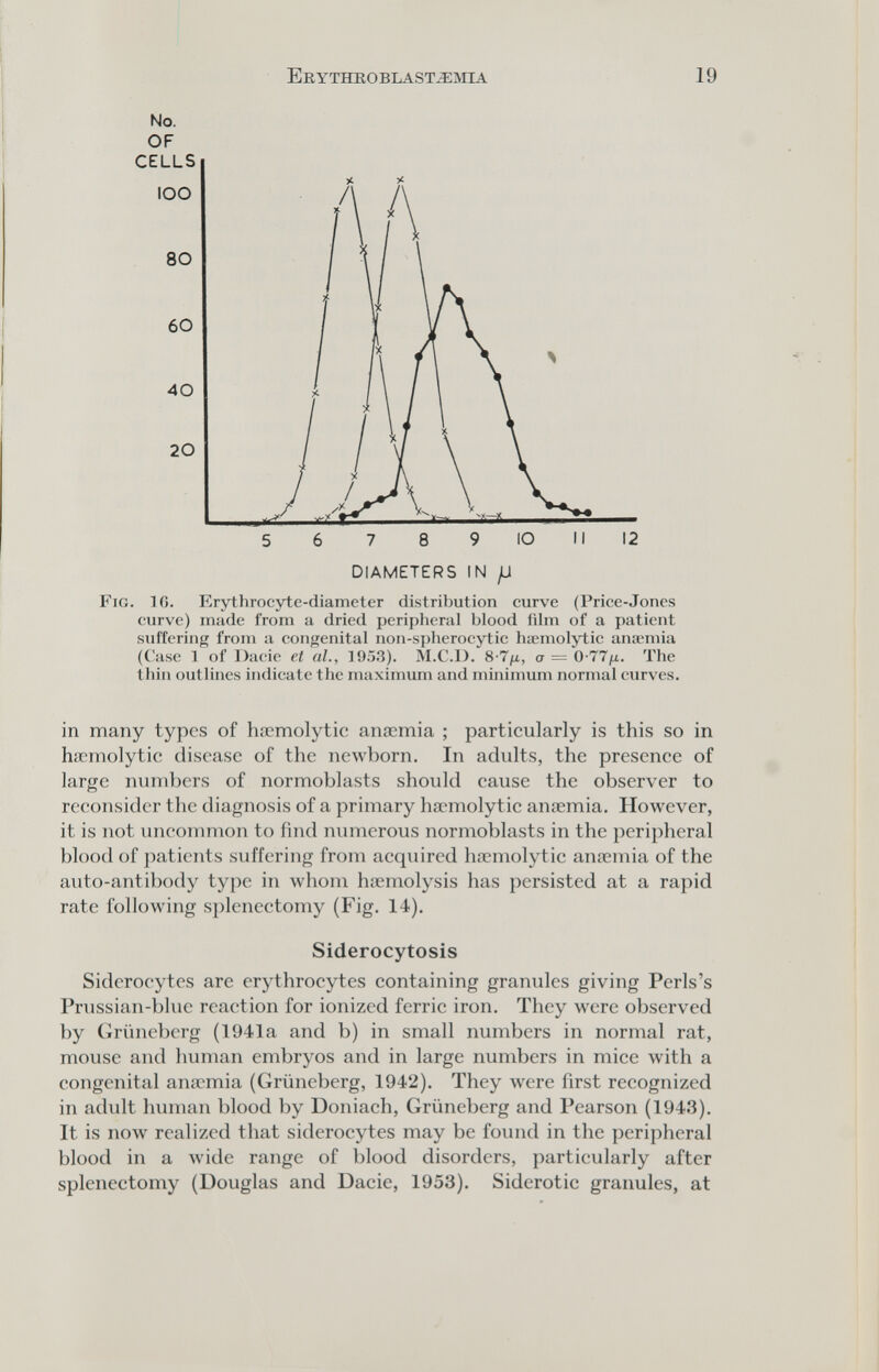 EllYTKROBLAST.î::\nA 19 No. OF DIAMETERS IN Fig. IG. Erythrocyte-diameter distribution curve (Price-Jones curve) made from a dried peripheral blood film of a patient suffering from a congenital non-spherocytic hiemolytic anaemia (Case 1 of Dacie et al, ]9Г).3). M.C.I). 8-7^, ст = 0-77/х. The thin outlines indicate the maximum and minimum normal curves. in many types of haemolytic anaemia ; particularly is this so in hscmolytic disease of the пелуЬогп. In adults, the presence of large numbers of normoblasts should cause the observer to reconsider the diagnosis of a primary haemolytic anœmia. However, it is not uncommon to find numerous normoblasts in the peripheral blood of patients suffering from acquired hocmolytic anoemia of the auto-antibody type in whom hiemolysis has persisted at a rapid rate following splenectomy (Fig. 14). Siderocytosis Siderocytcs are erythrocytes containing granules giving Perls's Prussian-blue reaction for ionized ferric iron. They were observed by Grüneberg (1941a and b) in small numbers in normal rat, mouse and human embryos and in large numbers in mice with a congenital anœmia (Grüneberg, 1942). They were first recognized in adult human blood by Doniach, Grüneberg and Pearson (1943). It is ПОЛУ realized that siderocytcs may be found in the peripheral blood in a Avide range of blood disorders, particularly after splenectomy (Douglas and Dacie, 1953). Siderotic granules, at