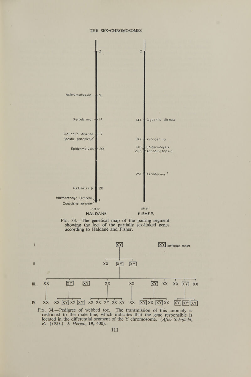 THE SEX-CHROMOSOMES ■О Achromatopsia - -9 Xeroderma Oguchi's disease Spastic paraplegia Epidermolysis - - 20 Relimtis p 28 Hoemorrhogic Diathesis^ Convulsive disorder'' after HALDANE O- 14 - 17 19.8ч, 20.5 14.1 - -Oguchl's disease 18.2 - -Xeroderma Epidermolysis Achromatopsia 25.1 - Xeroderma ' after FISHER. Fig. 33.—The genetical map of the pairing segment showing the loci of the partially sex-linked genes according to Haldane and Fisher. XX |XY] XX [^Yl [XYl —I— XX XX ИЗ: affected males XX XX |x3 XX IV. XX XX(^XX[^ XX XX XY XX XY XX |^xx[^xx Fig. 34.—Pedigree of webbed toe. The transmission of this anomaly is restricted to the male line, which indicates that the gene responsible is located in the differential segment of the Y chromosome. (After Schofield R. (1921.) J. Hered., 19, 400). Ill