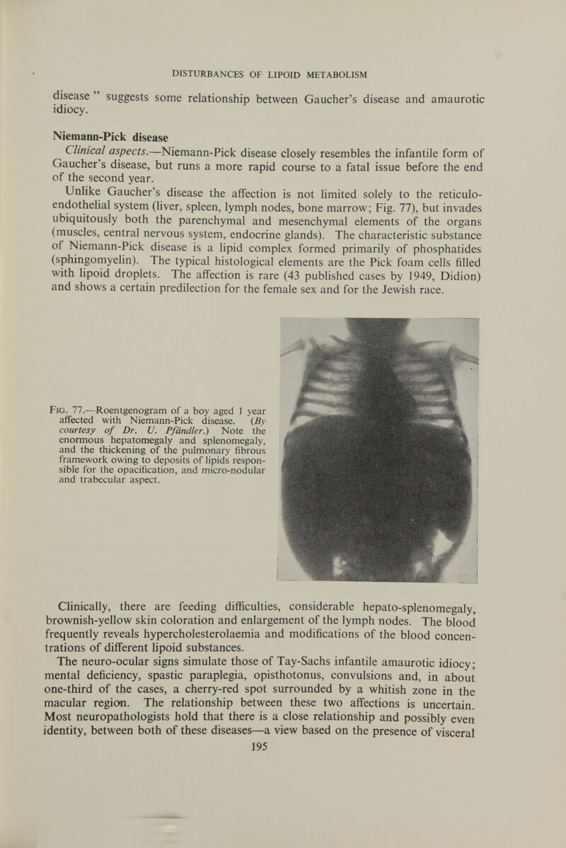 DISTURBANCES OF LIPOID METABOLISM disease  suggests some relationship between Gaucher's disease and amaurotic idiocy, Niemann-Pick disease Clinical aspects.—Niemann-Pick disease closely resembles the infantile form of Gaucher's disease, but runs a more rapid course to a fatal issue before the end of the second year. Unlike Gaucher's disease the affection is not limited solely to the reticulo- endothehal system (hver, spleen, lymph nodes, bone marrow; Fig. 77), but invades ubiquitously both the parenchymal and mesenchymal elements of the organs (muscles, central nervous system, endocrine glands). The characteristic substance of Niemann-Pick disease is a lipid complex formed primarily of phosphatides (sphingomyelin). The typical histological elements are the Pick foam cells filled with lipoid droplets. The affection is rare (43 published cases by 1949, Didion) and shows a certain predilection for the female sex and for the Jewish race. Fig. 77.—Roentgenogram of a boy aged 1 year affected with Niemann-Pick disease. (By courtesy of Dr. U. Pfändler.) Note the enormous hepatomegaly and splenomegaly, and the thickening of the pulmonary fibrous framework owing to deposits of lipids respon¬ sible for the opacification, and micro-nodular and trabecular aspect. Clinically, there are feeding difficulties, considerable hepato-splenomegaly, brownish-yellow skin coloration and enlargement of the lymph nodes. The blood frequently reveals hypercholesterolaemia and modifications of the blood concen¬ trations of different lipoid substances. The neuro-ocular signs simulate those of Tay-Sachs infantile amaurotic idiocy; mental deficiency, spastic paraplegia, opisthotonus, convulsions and, in about one-third of the cases, a cherry-red spot surrounded by a whitish zone in the macular region. The relationship between these two affections is uncertain. Most neuropathologists hold that there is a close relationship and possibly even identity, between both of these diseases—a view based on the presence of visceral 195