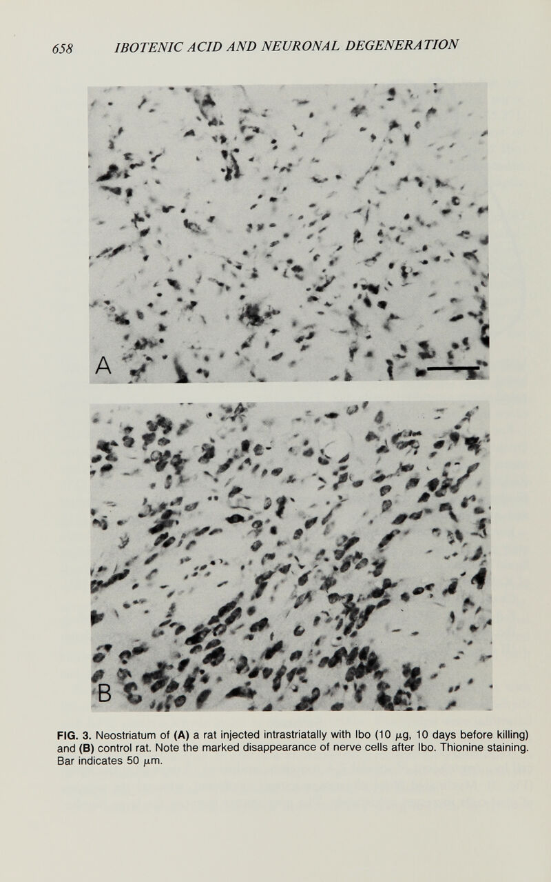 658 IBOTENIC ACID AND NEURONAL DEGENERATION I fI ît- ^4» *0^ jm Ч -*•■.'■' ' ■• * * .' '. г>>., tir#* •• *•♦ '•.с, - -t, Vs' ,.- -''' ' ^ «4 .'• *^ • ' ' Í « V ' . • > 'si •*• • 'tv**' ? 'Л . >• • ->' ' î > Sj»* •* ^ * . ll»f • 'À •u»; ^ '-4 A V'U''- -T \ •♦ ♦. . ^ к 1  It—тС ^ ф^ .* # ^ ^ 4 Vf Ш* . /í; ' \A¿? ^ ---v 1^ # * • *- « <í-^3fr ♦V* V/' é 'Г • л i * ^ ■■'# •r-' ::'Г- ''Л .'Цг-. 'Л- ## 'm m «<* FIG. 3. Neostriatum of (A) a rat injected intrastriatally with ibo (10 ftg, 10 days before killing) and (B) control rat. Note the marked disappearance of nerve cells after Ibo. Thionine staining. Bar indicates 50 ju,m.