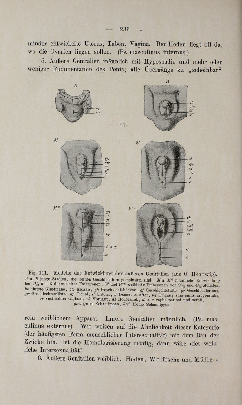 — 236 — minder entwickelte Uterus, Tuben, Vagina. Der Hoden liegt oft da, wo die Ovarien liegen sollen. (Ps. masculinus internus.) 5. Äußere Genitalien männlich mit Hypospadie und mehr oder weniger Rudimentation des Penis; alle Übergänge zu „scheinbar M Я d. M. т Fig. 111. Modelle der Entwicklung der äußeren Genitalien (aus 0. Hertwig). Ä u. в junge Stadien, die beiden Geschlechtern gemeinsam sind. Ж u. M* männliche Entwicklung bei 21/2 und 3 Monate alten Embryonen, W und W* weibliche Embryonen von 21/2 nnd 41/2 Monaten. he hintere Gliedmaße, clo Kloake, gh Geschlechtshöcker, gf Geschlechtsfalte, gr Geschlechtsrinne, gto Geschlechtswülste, gp Eichel, cl Clitoris, d Damm, a After, ug Eingang zum sinus urogenitalis, vv vestibulum vaginae, vh Vorhaut, hs Hodensack, d u. r raphe perinei und scroti, gsch große Schamlippen, ksch kleine Schamlippen rein weiblichem Apparat. Innere Genitalien männlich. (Ps. mas¬ culinus externus). Wir weisen auf die Ähnlichkeit dieser Kategorie (der häufigsten Form menschlicher Intersexualität) mit dem Bau der Zwicke hin. Ist die Homologisierung richtig, dann wäre dies weib¬ liche Intersexualität! 6. Äußere Genitalien weiblich. Hoden, Wolffsche und Müller-
