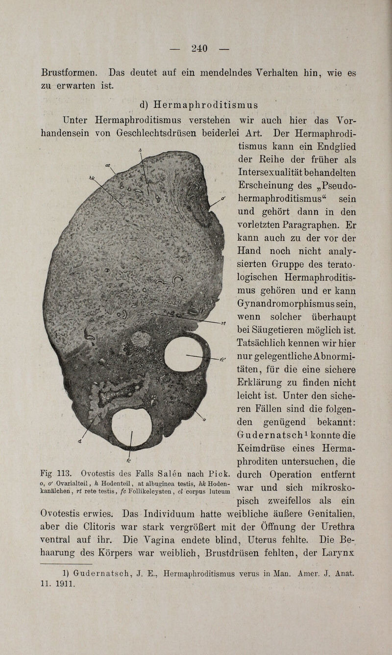 — 240 — Brustformen. Das deutet auf ein mendelndes Verhalten hin, wie es zu erwarten ist. d) Hermaphroditismus Unter Hermaphroditismus verstehen wir auch hier das Vor¬ handensein von Geschlechtsdrüsen beiderlei Art. Der Hermaphrodi¬ tismus kann ein Endglied der Reihe der früher als Intersexualität behandelten Erscheinung des „Pseudo- hermaphroditismus sein und gehört dann in den vorletzten Paragraphen. Er kann auch zu der vor der Hand noch nicht analy¬ sierten G-ruppe des terato- logischen Hermaphroditis¬ mus gehören und er kann Gynandromorphismus sein, wenn solcher überhaupt bei Säugetieren möglich ist. Tatsächlich kennen wir hier nur gelegentliche Abnormi¬ täten, für die eine sichere Erklärung zu finden nicht leicht ist. Unter den siche¬ ren Fällen sind die folgen¬ den genügend bekannt: Gudernatsch^ konnte die Keimdrüse eines Herma¬ phroditen untersuchen, die Fig 113. Ovotestis des Falls Salea nach Pick, durch Operation entfernt 0, 0' Ovarialteil, л HodenteU, at albugínea testis, ЛА: Hoden- i - i rnitrneVn kanälohen, ri rete testis,/с Follikelcysten, ci corpus luteum imüiUbJtu- pisch zweifellos als ein Ovotestis erwies. Das Individuum hatte weibliche äußere Genitalien, aber die Clitoris war stark vergrößert mit der Öffnung der Urethra ventral auf ihr. Die Vagina endete blind, Uterus fehlte. Die Be¬ haarung des Körpers war Aveiblich, Brustdrüsen fehlten, der Larynx 1) Gudernatsch, J. E., Hermaphroditismus verus in Man. Amer. J. Anat. 11. 1911.