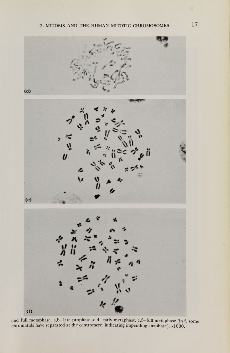 2. MITOSIS AND THE HUMAN MITOTIC CHROMOSOMES (d) 4 « I ^ ь ф* •►v -231 r . ' - % « ^ ^ Чг# # Ce) ^ 4 ^ ^ A Ï* v> I/ - ^ I/ ^ г. - - i^\\ < \\ ÌV ' n (I V 'Iv %% «ъ « -fn A ^ i> % Cf) * w ^ •r» ^ A 1% *5» II л Ч t •J^ •# 5*  »«• WV » % /[ ^ V '' . ' ^ * Л 'i Ш Я and full metaphase. a,b-late prophase. c,d-early metaphase. e,f-full metaphase (in f, chromatids have separated at the centromere, indicating impending anaphase). xlOOO.