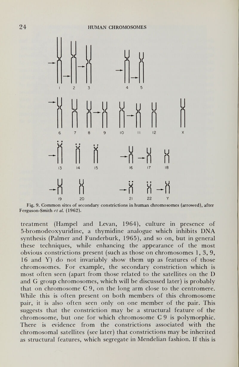 24 HUMAN CHROMOSOMES X X DC H y У U_U W и !J H IO II 12 ь< it: il 14 16 b¿ 19 íi 20 Ü «-íi 21 22 Fig. 9. Common sites of secondary constrictions in human chromosomes (arrowed), after Ferguson-Smith et al. (1962). treatment (Hampel and Levan, 1964), culture in presence of 5-bromodeoxyuridine, a thymidine analogue which inhibits DNA synthesis (Palmer and Funderburk, 1965), and so on, but in general these techniques, while enhancing the appearance of the most obvious constrictions present (such as those on chromosomes 1, 3, 9, 16 and Y) do not invariably show them up as features of those chromosomes. For example, the secondary constriction which is most often seen (apart from those related to the satellites on the D and G group chromosomes, which will be discussed later) is probably that on chromosome С 9, on the long arm close to the centromere. While this is often present on both members of this chromosome pair, it is also often seen only on one member of the pair. This suggests that the constriction may be a structural feature of the chromosome, but one for which chromosome С 9 is polymorphic. There is evidence from the constrictions associated with the chromosomal satellites (see later) that constrictions may be inherited as structural features, which segregate in Mendelian fashion. If this is