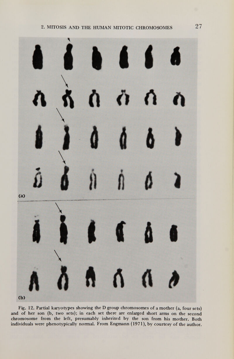 2. MITOSIS AND THE HUMAN MITOTIC CHROMOSOMES 27 Ca) (b) \ \ é #1 Ì I И Í M л Л л rt rt Fig. 12. Partial karyotypes showing the D group chromosomes of a mother (a, four sets) and of her son (b, two sets); in each set there are enlarged short arms on the second chromosome from the left, presumably inherited by the son from his mother. Both individuals were phenotypically normal. From Engmann (1971), by courtesy of the author.