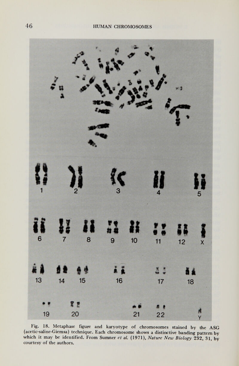 46 HUMAN CHROMOSOMES к m t ^ , ! * tt A * 3 )l << и i и li :: Il 6 8 9 10 f f f • 11 Ili ( 12 X il «i «4 13 14 15 « m ft i 16 ч » *• # 17 là 18 il Ш л ' 19 20 21 22 Y Fig. 18. Metaphase figure and karyotype of chromosomes stained by the ASG (acetic-saline-Giemsa) technique. Each chromosome shows a distinctive banding pattern by which it may be identified. From Sumner et al. (1971), Nature New Biology 232, 31, by courtesy of the authors. • • ? г