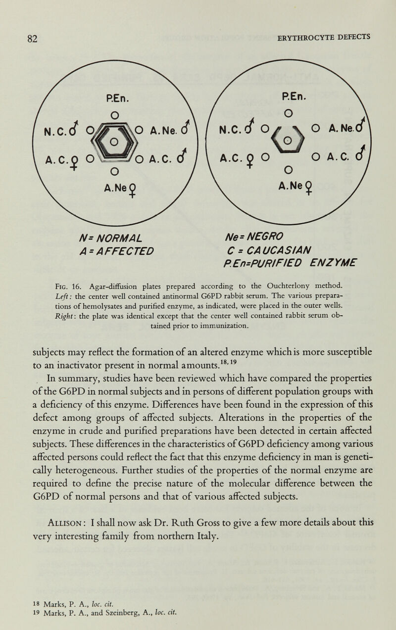 82 erythrocyte defects N= NORMAL Ne= NEGRO A = A FFECTED С ^ CA UCA S IAN P.En=PURlFIED ENZYME Fig. 16. Agar-difFusion plates prepared according to the Ouchterlony method. heft : the center well contained antinormal G6PD rabbit serum. The various prepara¬ tions of hemolysates and purified enzyme, as indicated, were placed in the outer wells. Right: the plate was identical except that the center well contained rabbit serum ob¬ tained prior to immunization. subjects may reflect the formation of an altered enzyme which is more susceptible to an inactivator present in normal amounts.^®■'^ In summary, studies have been reviewed which have compared the properties of the G6PD in normal subjects and in persons of different population groups with a deficiency of this enzyme. Differences have been found in the expression of this defect among groups of affected subjects. Alterations in the properties of the enzyme in crude and purified preparations have been detected in certain affected subjects. These differences in the characteristics of G6PD deficiency among various affected persons could reflect the fact that this enzyme deficiency in man is geneti¬ cally heterogeneous. Further studies of the properties of the normal enzyme are required to define the precise nature of the molecular difference between the G6PD of normal persons and that of various affected subjects. Allison : I shall now ask Dr. Ruth Gross to give a few more details about this very interesting family from northern Italy. 18 Marks, P. A., ÍOC. cit. l^ Marks, P. A., and Szeinberg, A., loc. cit.