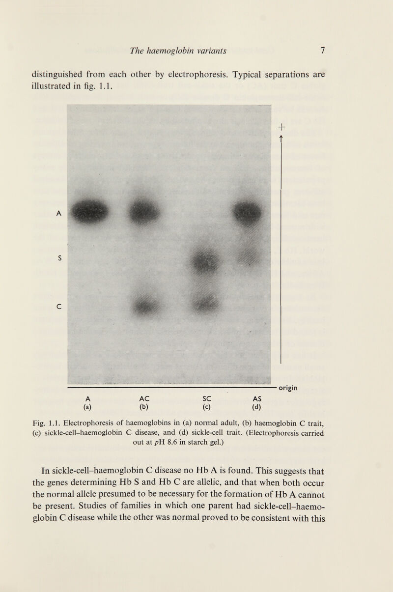 The haemoglobin variants 7 distinguished from each other by electrophoresis. Typical separations are illustrated in fig. 1.1. (a) (b) (c) (d) Fig. 1.1. Electrophoresis of haemoglobins in (a) normal adult, (b) haemoglobin С trait, (c) sickle-ceU-haemoglobin С disease, and (d) sickle-ceU trait. (Electrophoresis carried out at рИ. 8.6 in starch gel.) In sickle-cell-haemoglobin С disease no Hb A is found. This suggests that the genes determining Hb S and Hb С are allelic, and that when both occur the normal allele presumed to be necessary for the formation of Hb A cannot be present. Studies of families in which one parent had sickle-cell-haemo- globin С disease while the other was normal proved to be consistent with this