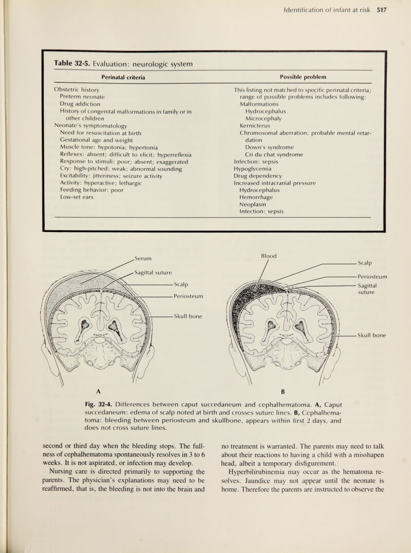 Identification of infant at risk 517 Serum Sagittal suture Blood ■Scalp ■ Periosteum ■ Skull bone В Fig. 32-4. Differences between caput succedaneum and cephalhematoma. A, Caput succedaneum: edema of scalp noted at birth and crosses suture lines. B, Cephalhema¬ toma: bleeding between periosteum and skullbone, appears within first 2 days, and does not cross suture lines. Scalp Periosteum Sagittal suture Skull bone second or third day when the bleeding stops. The full¬ ness of cephalhematoma spontaneously resolves in 3 to 6 weeks. It is not aspirated, or infection may develop. Nursing care is directed primarily to supporting the parents. The physician's explanations may need to be reaffirmed, that is, the bleeding is not into the brain and no treatment is warranted. The parents may need to talk about their reactions to having a child with a misshapen head, albeit a temporary disfigurement. Hyperbilirubinemia may occur as the hematoma re¬ solves. Jaundice may not appear until the neonate is home. Therefore the parents are instructed to observe the