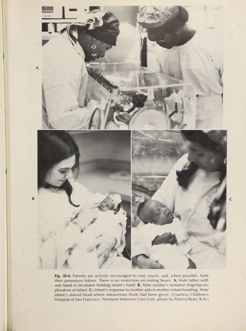 Fig. 33-4. Parents are actively encouraged to visit, touch, and, when possible, hold their premature babies. There is no restriction on visiting hours. A, Note father with one hand in incubator holding infant's hand. B, Note mother's tentative fingertip ex¬ ploration of infant. C, Infant's response to mother aids in mother-infant bonding. Note infant's shaved head where intravenous fluids had been given. (Courtesy Children's Hospital of San Francisco, Newborn Intensive Care Unit; photo by Patricia Ryan, R.N.)