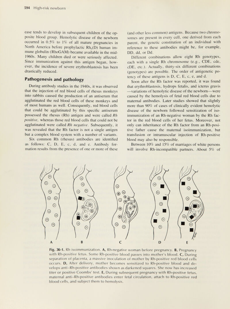 594 High-risk newborn ease tends to develop in subsequent children of the op¬ posite blood group. Hemolytic disease of the newborn occurred in 0.5% to 1% of all mature pregnancies in North America before prophylactic Rh„(D) human im¬ mune globulin (RhoGAM) became available in the mid- 1960s. Many children died or were seriously affected. Since immunization against this antigen began, how¬ ever, the incidence of severe erythroblastosis has been drastically reduced. Pathogenesis and pathology During antibody studies in the 1940s, it was observed that the injection of red blood cells of rhesus monkeys into rabbits caused the production of an antiserum that agglutinated the red blood cells of these monkeys and of most humans as well. Consequently, red blood cells that could be agglutinated by this specific antiserum possessed the rhesus (Rh) antigen and were called Rh positive, whereas those red blood cells that could not be agglutinated were called Rh negative. Subsequently, it was revealed that the Rh factor is not a single antigen but a complex blood system with a number of variants. Six common Rh (rhesus) antibodies are identified as follows; C, D, E, c, d, and e. Antibody for¬ mation results from the presence of one or more of these (and other less common) antigens. Because two chromo¬ somes are present in every cell, one derived from each parent, the genetic constitution of an individual with reference to these antibodies might be, for example, DD, dd, or Dd. Different combinations allow eight Rh genotypes, each with a single Rh chromosome (e.g., CDE, cde, cDE, etc.). Actually, thirty-six different combinations (genotypes) are possible. The order of antigenetic po¬ tency of these antigens is D, C, E, c, e, and d. Soon after the Rh factor was reported, it was found that erythroblastosis, hydrops fetalis, and icterus gravis —variations of hemolytic disease of the newborn—were caused by the hemolysis of fetal red blood cells due to maternal antibodies. Later studies showed that slightly more than 90% of cases of clinically evident hemolytic disease of the newborn followed sensitization of iso¬ immunization of an Rh-negative woman by the Rh fac¬ tor in the red blood cells of her fetus. Moreover, not only can inheritance of the Rh factor from an Rh-posi- tive father cause the maternal isoimmunization, but transfusion or intramuscular injection of Rh-positive blood may also be responsible. Between 10% and 15% of marriages of white persons will involve Rh-incompatible partners. About 5% of Fig. 36-1. Rh isoimmunization. A, Rh-negative woman before pregnancy. B, Pregnancy with Rh-positive fetus. Some Rh-positive blood passes into mother's blood. C, During separation of placenta, a massive inoculation of mother by Rh-positive red blood cells occurs. D, After delivery, mother becomes sensitized to Rh-positive blood and de¬ velops anti-Rh-positive antibodies shown as darkened squares. She now has increased titer or positive Coombs' test. E, During subsequent pregnancy with Rh-positive fetus, maternal anti-Rh-positive antibodies enter fetal circulation, attach to Rh-positive red blood cells, and subject them to hemolysis.