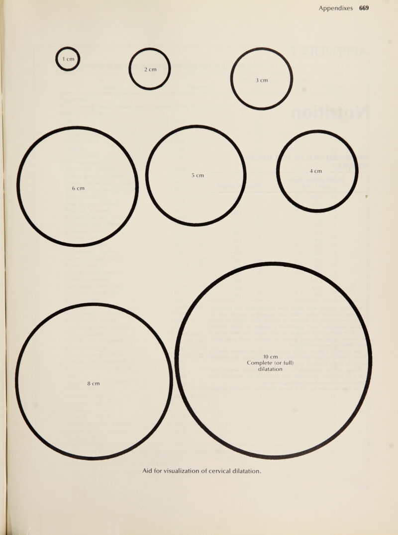 visualization of cervical dilatation.