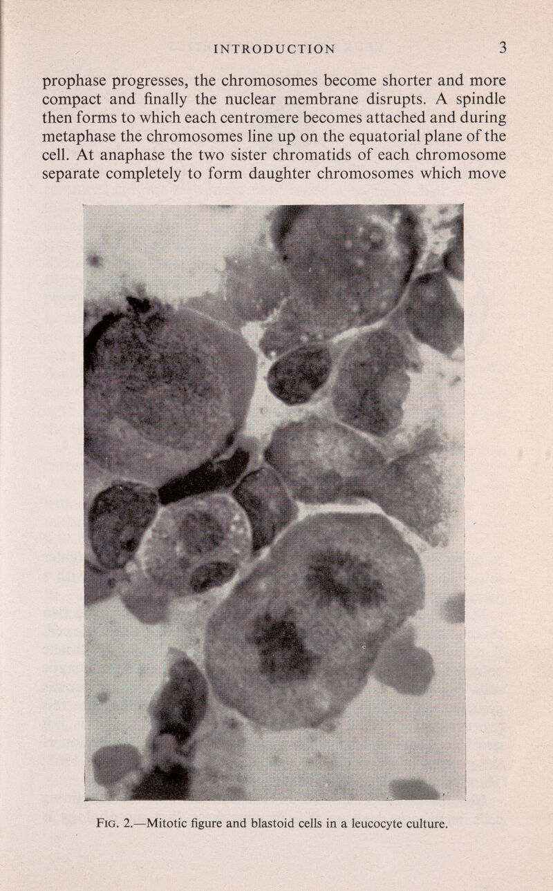 INTRODUCTION 3 prophase progresses, the chromosomes become shorter and more compact and finally the nuclear membrane disrupts. A spindle then forms to which each centromere becomes attached and during metaphase the chromosomes line up on the equatorial plane of the cell. At anaphase the two sister chromatids of each chromosome separate completely to form daughter chromosomes which move Fig. 2.—Mitotic figure and blastoid cells in a leucocyte culture.