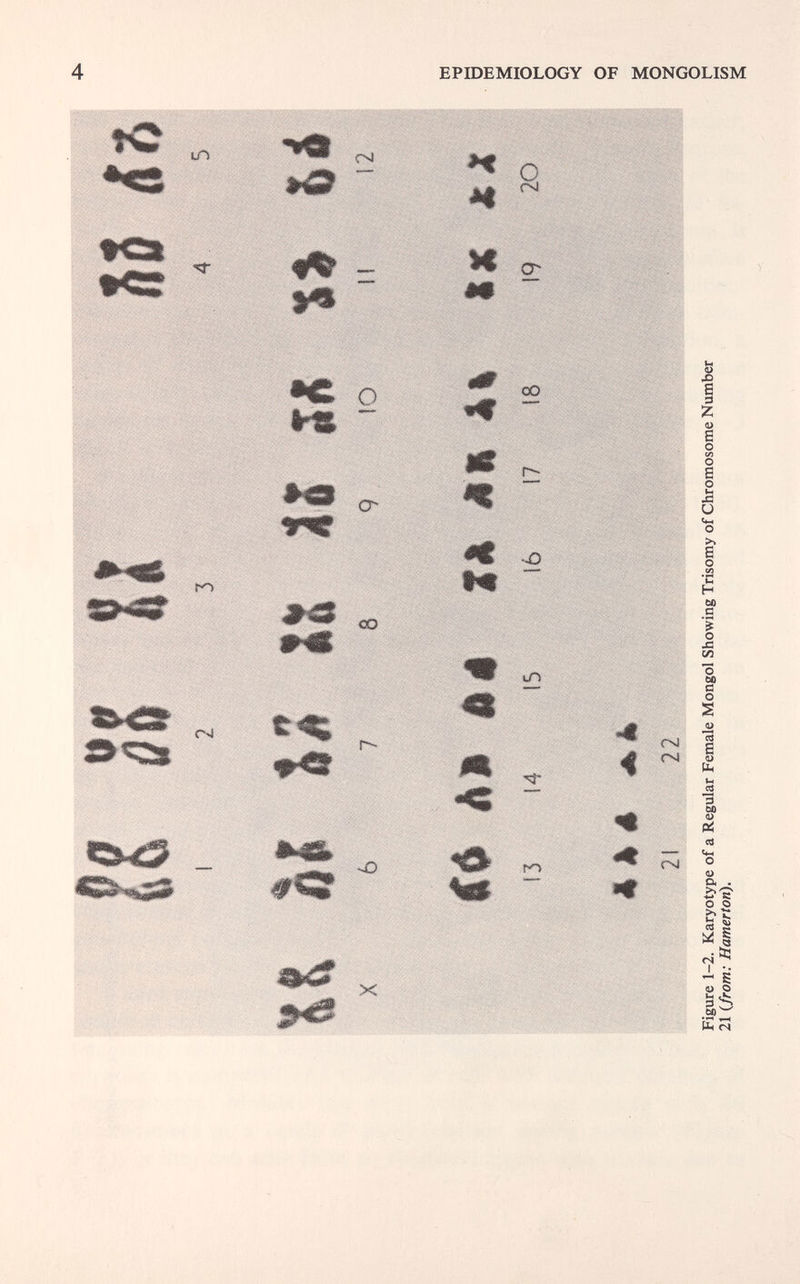 4 EPIDEMIOLOGY OF MONGOLISM