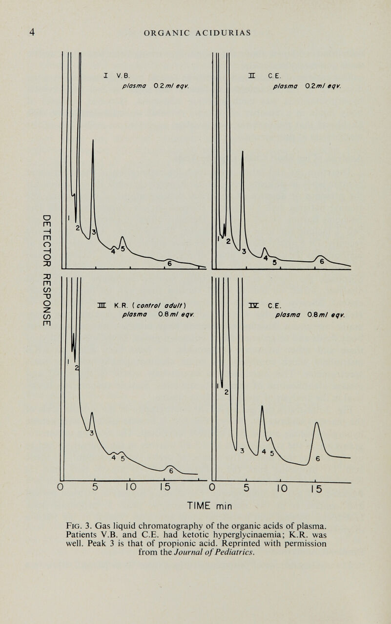 4 ORGANIC ACIDURIAS I V.B. plasma O.Z m! eqy. lit K.R. ^control odu/t) plasma 0.8 ml eqv. 0 H CE. plasma O.Zm/ eqv. yi VJ ж CE. plasma О.Ът! eqv. IO 15 0 5 TIME min ' IO Fig. 3. Gas liquid chromatography of the organic acids of plasma. Patients V.B. and C.E. had ketotic hyperglycinaemia; K.R. was well. Peak 3 is that of propionic acid. Reprinted with permission from the Journal of Pediatrics.