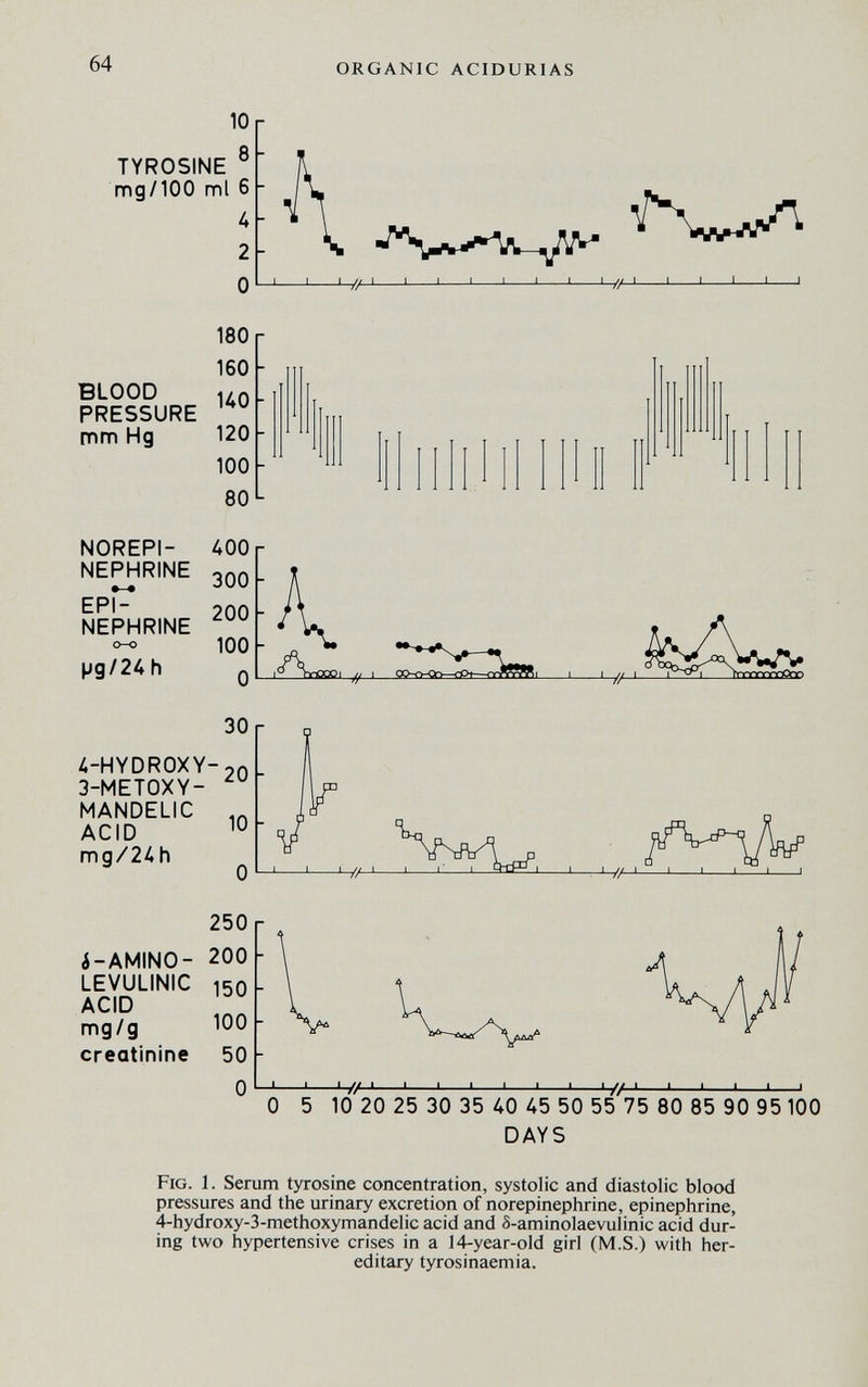 10 ml 6 и 2 О 180 160 КО 120 100 80 /ЮО 300 200 100 О 30 20 10 О 250 200 150 100 50 О I. Ser ires ai roxv-: ORGANIC ACIDURIAS I I ¡—//-J I I I 1 I 1 ' ' ' ' ' i<Av«X>i , J I L-t/-' 1—^ J 1 '-//—' ' ' ' I 1 I // I 1 1 I I I -//- -I I l_ -I I ■ ' I I 0 5 10 20 25 30 35 40 45 50 55 75 80 85 90 95100 DAYS n tyrosine concentration, systolic and diastolic blood J the urinary excretion of norepinephrine, epinephrine, methoxymandelic acid and S-aminolaevulinic acid dur- ertensive crises in a 14-year-old girl (M.S.) with her¬ editary tyrosinaemia.