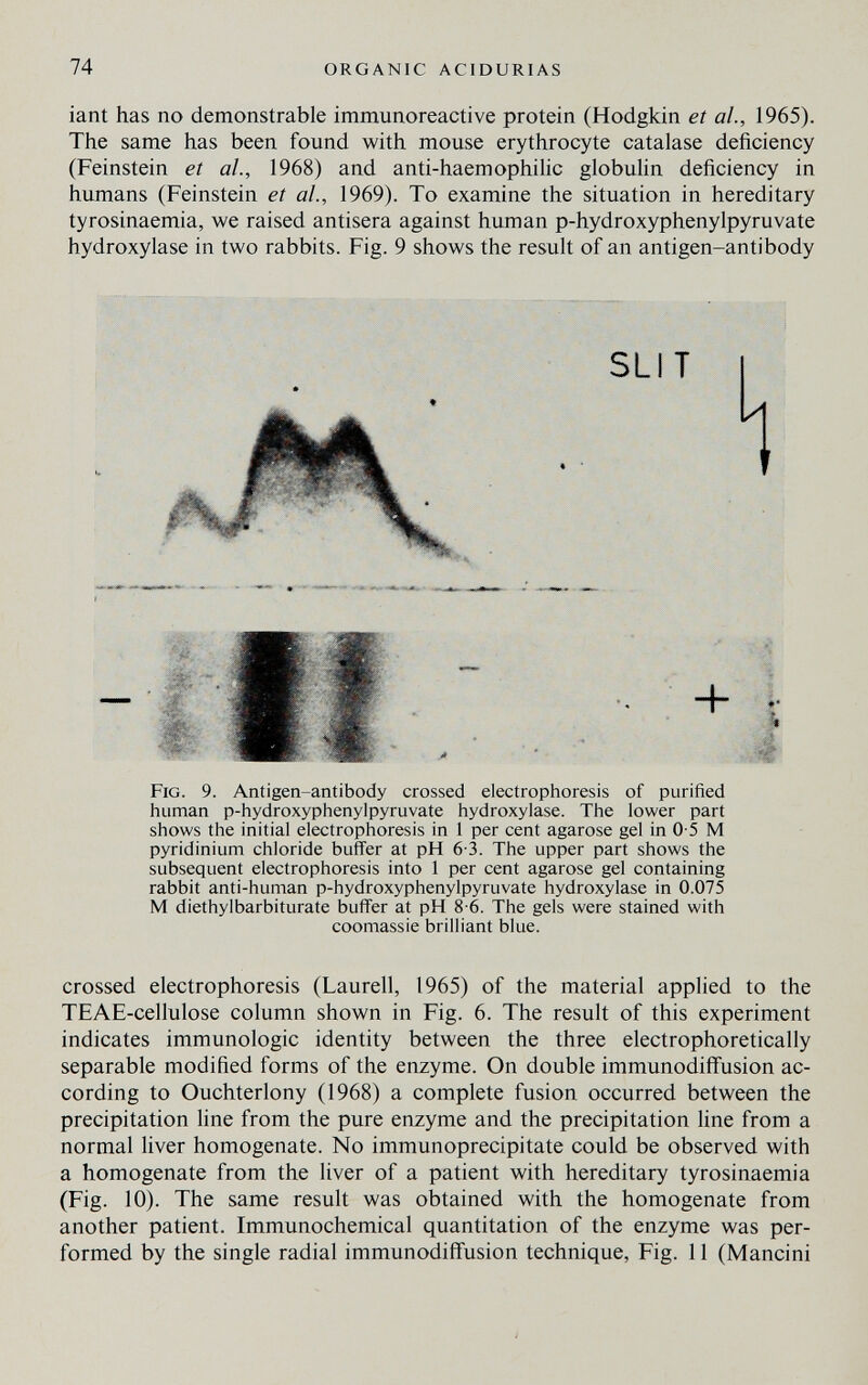 74 ORGANIC ACIDURIAS iant has no demonstrable immunoreactive protein (Hodgkin et al., 1965). The same has been found with mouse erythrocyte catalase deficiency (Feinstein et al., 1968) and anti-haemophihc globulin deficiency in humans (Feinstein et al., 1969). To examine the situation in hereditary tyrosinaemia, we raised antisera against human p-hydroxyphenylpyruvate hydroxylase in two rabbits. Fig. 9 shows the result of an antigen-antibody SLIT Fig. 9. Antigen-antibody crossed electrophoresis of purified human p-hydroxyphenylpyruvate hydroxylase. The lower part shows the initial electrophoresis in 1 per cent agarose gel in 0-5 M pyridinium chloride buffer at pH 6-3. The upper part shows the subsequent electrophoresis into 1 per cent agarose gel containing rabbit anti-human p-hydroxyphenylpyruvate hydroxylase in 0.075 M diethylbarbiturate buffer at pH 8-6. The gels were stained with coomassie brilliant blue. crossed electrophoresis (Laurell, 1965) of the material applied to the TEAE-cellulose column shown in Fig. 6. The result of this experiment indicates immunologic identity between the three electrophoretically separable modified forms of the enzyme. On double immunodiff'usion ac¬ cording to Ouchterlony (1968) a complete fusion occurred between the precipitation line from the pure enzyme and the precipitation line from a normal liver homogenate. No immunoprecipitate could be observed with a homogenate from the liver of a patient with hereditary tyrosinaemia (Fig. 10). The same result was obtained with the homogenate from another patient. Immunochemical quantitation of the enzyme was per¬ formed by the single radial immunodiffusion technique, Fig. 11 (Mancini