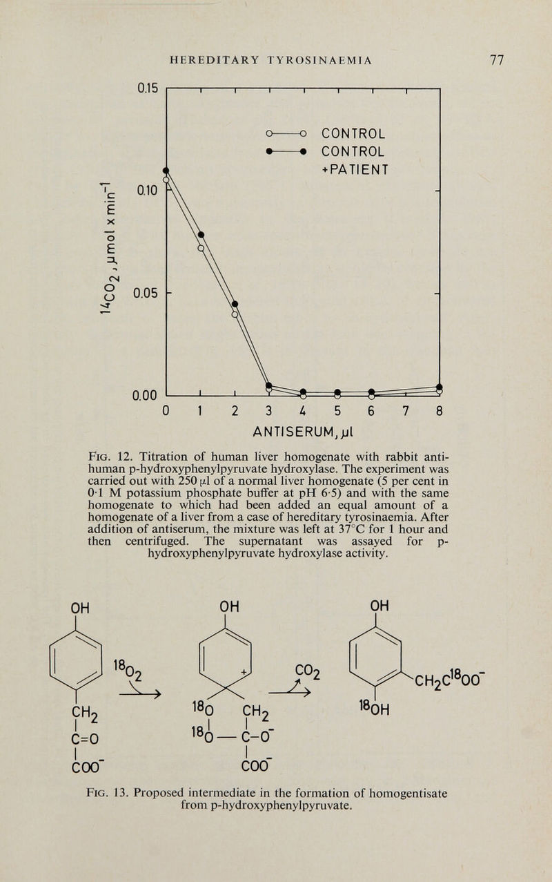 HEREDITARY TYROSINAEMIA 0.15 0.10 1 X o £ CM s 0.05 0.00 ' 01 2345678 ANTISERUM,pi Fio. 12. Titration of human liver homogenate with rabbit anti- human p-hydroxyphenylpyruvate hydroxylase. The experiment was carried out with 250 ¡xl of a normal liver homogenate (5 per cent in 0-1 M potassium phosphate buffer at pH 6-5) and with the same homogenate to which had been added an equal amount of a homogenate of a liver from a case of hereditary tyrosinaemia. After addition of antiserum, the mixture was left at 37°C for 1 hour and then centrifuged. The supernatant was assayed for p- hydroxyphenylpyruvate hydroxylase activity. OH 18, CH, I ^ c=o I _ coo OH COo 18o CHo IftI 1 - '8o—C-0 I _ COO OH .1£ 180H Fig. 13. Proposed intermediate in the formation of homogentisate from p-hydroxyphenylpyruvate.