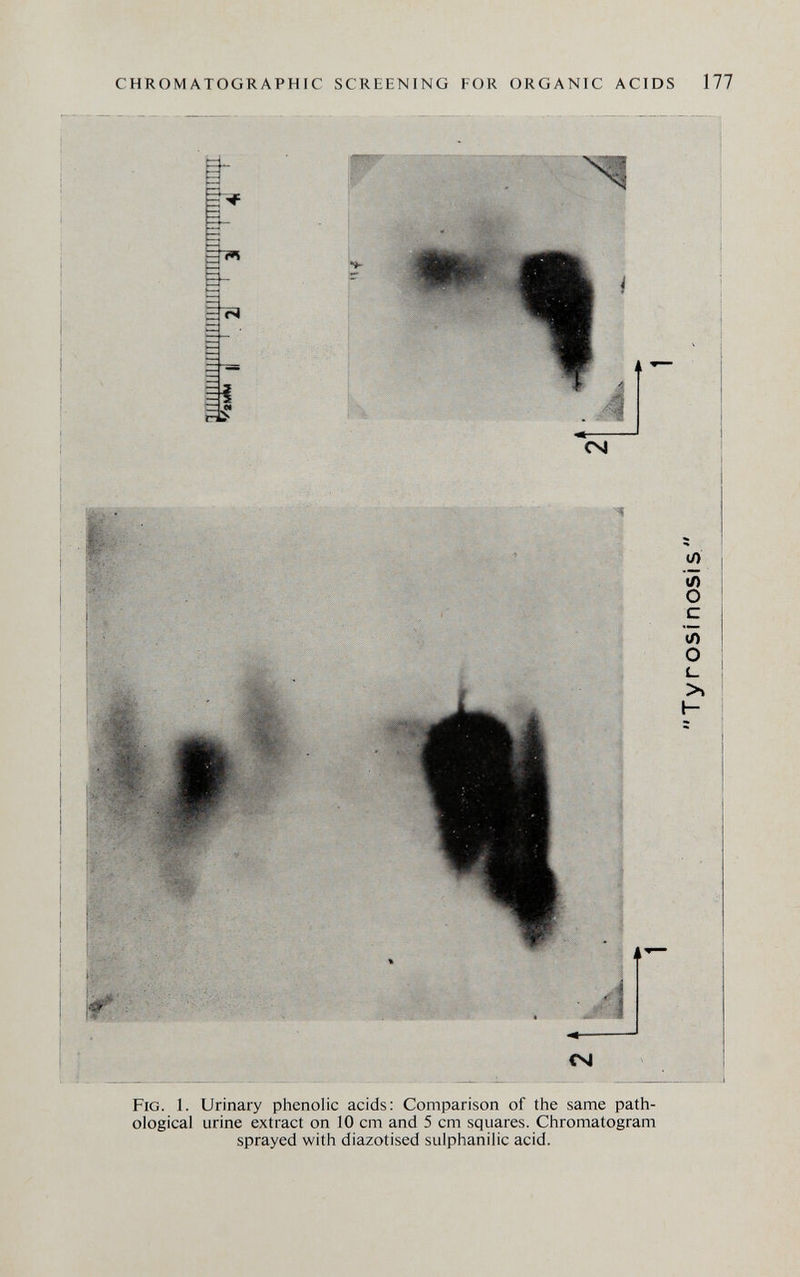 CHROMATOGRAPHIC SCREENING FOR ORGANIC ACIDS 177 CM Fig. 1. Urinary phenolic acids: Comparison of the same path¬ ological urine extract on 10 cm and 5 cm squares. Chromatogram sprayed with diazotised sulphanilic acid.