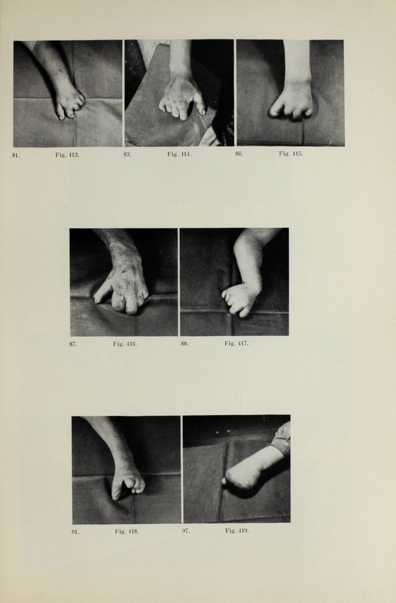 91. Fig. 118. 97. Fig. 419.