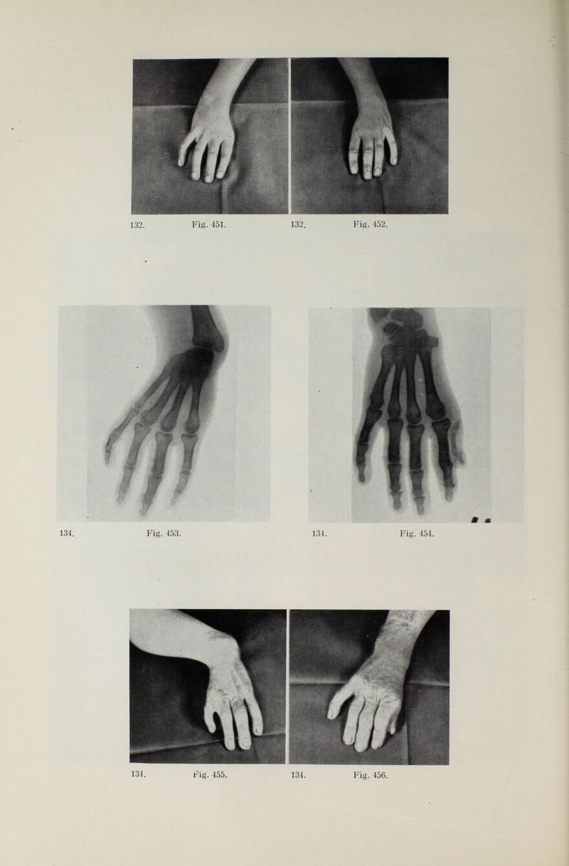 132. Fig. 451. 132. Fig. 452. 134. Fig. 453. m m 134. Fig. 454. 134. Fig. 455. 134. Fig. 456.