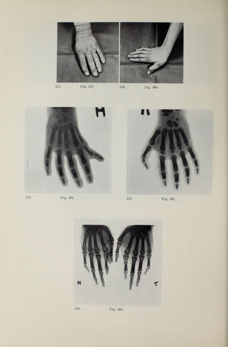 Fig. 481.