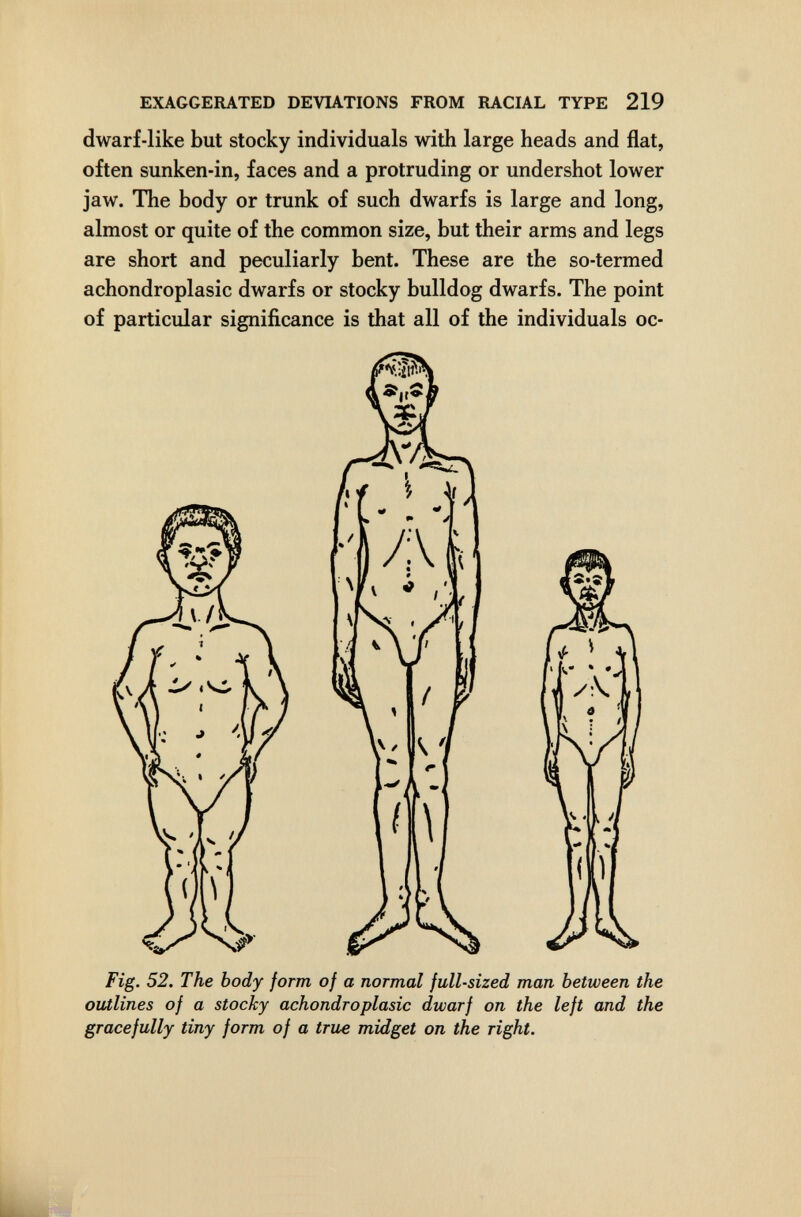 EXAGGERATED DEVUTIONS FROM RACIAL TYPE 219 dwarf-like but stocky individuals with large heads and flat, often sunken-in, faces and a protruding or undershot lower jaw. The body or trunk of such dwarfs is large and long, almost or quite of the common size, but their arms and legs are short and peculiarly bent. These are the so-termed achondroplasic dwarfs or stocky bulldog dwarfs. The point of particular significance is that all of the individuals oc- gr ace fully tiny form of a true midget on the right.