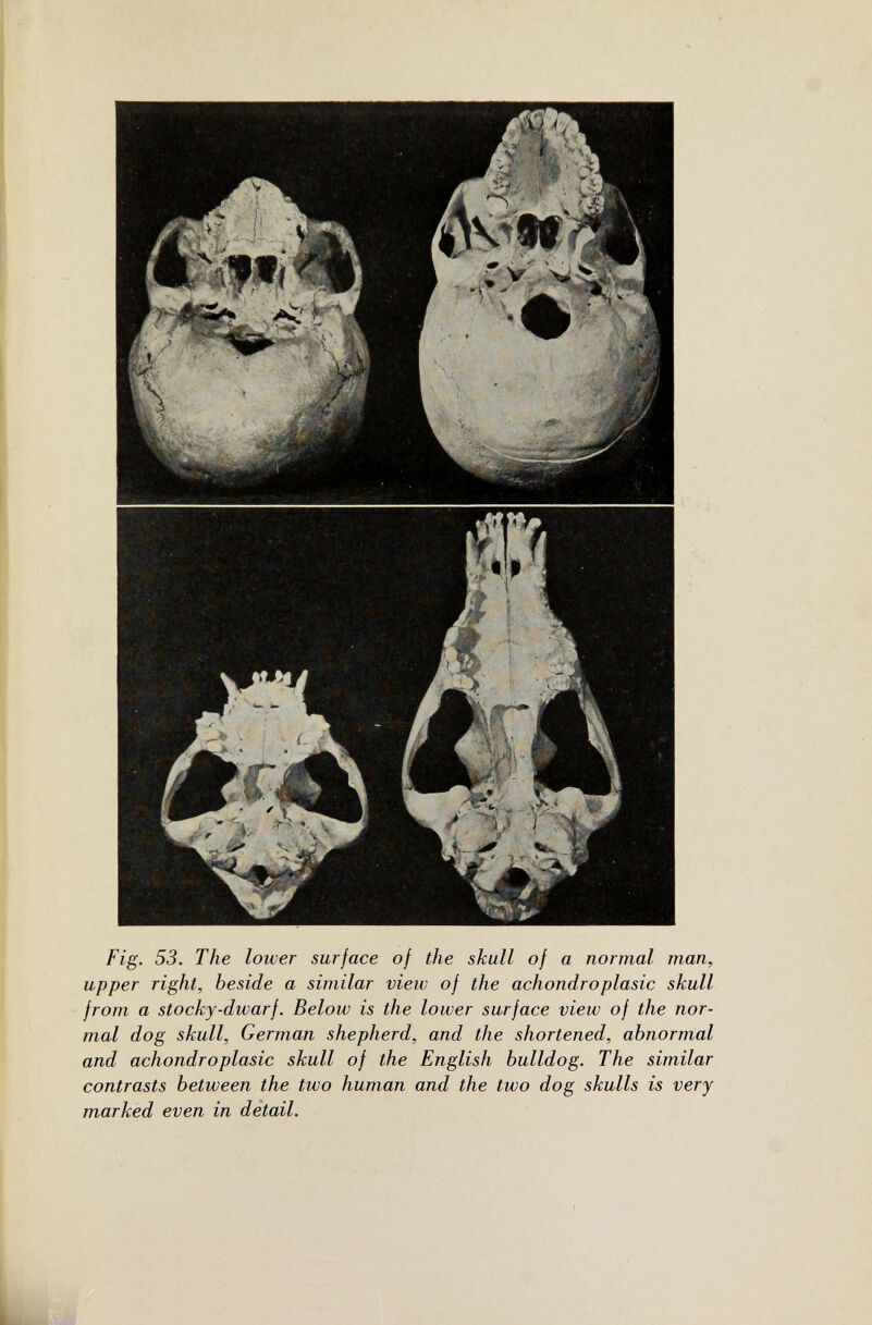 Fig. 53. The lower surface of the skull of a normal man, upper right, beside a similar view of the achondroplasia skull from a stocky-dwarf. Below is the lower surface view of the nor¬ mal dog skull, German shepherd, and the shortened, abnornial and achondroplasia skull of the English bulldog. The similar contrasts between the two human and the two dog skulls is very marked even in detail.