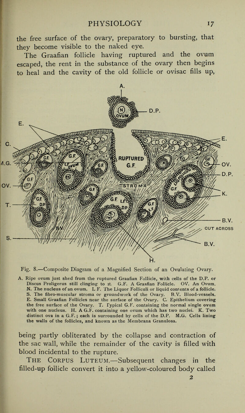 PHYSIOLOGY 17 the free surface of the ovary, preparatory to bursting, that they become visible to the naked eye. The Graafian follicle having ruptured and the ovum escaped, the rent in the substance of the ovary then begins to heal and the cavity of the old follicle or ovisac fills up. A. H. Fig. 8.—Composite Diagram of a Magnified Section of an Ovulating Ovary. A. Ripe ovum just shed from the ruptured Graafian Follicle, with cells of the D.P. or Discus Proligerus still clinging- to it. G.F. A Graafian Follicle. OV. An Ovum. N. The nucleus of an ovum. L F. The Liquor Folliculi or liquid contents of a follicle. S. The fibro-muscular stroma or groundwork of the Ovary. B.V. Blood-vessels. E. Small Graafian Follicles near the surface of the Ovary. C. Epithelium covering the free surface of the Ovary. T. Typical G.F. containing the normal single ovum with one nucleus. H. A G.F. containing one ovum which has two nuclei. K. Two distinct ova in a G.F. ; each is surrounded by cells of the D.P. M.G. Cells lining the walls of the follicles, and known as the Membrana Granulosa. being partly obliterated by the collapse and contraction of the sac wall, while the remainder of the cavity is filled with blood incidental to the rupture. The Corpus Luteum.—Subsequent changes in the filled-up follicle convert it into a yellow-coloured body called 2