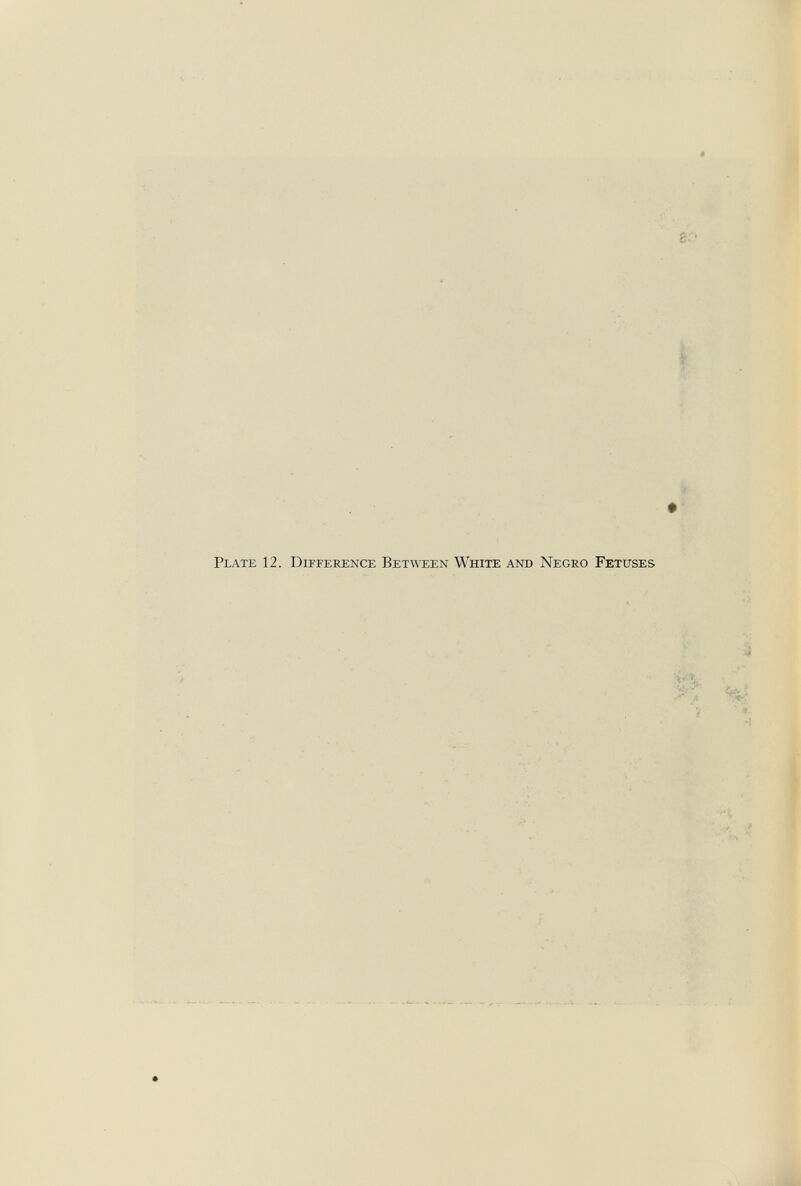 Plate 12. Difference Between White and Negro Fetuses